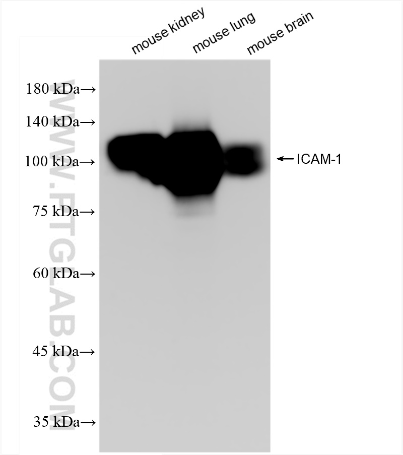 Western Blot (WB) analysis of various lysates using ICAM-1/CD54 Recombinant antibody (82827-8-RR)