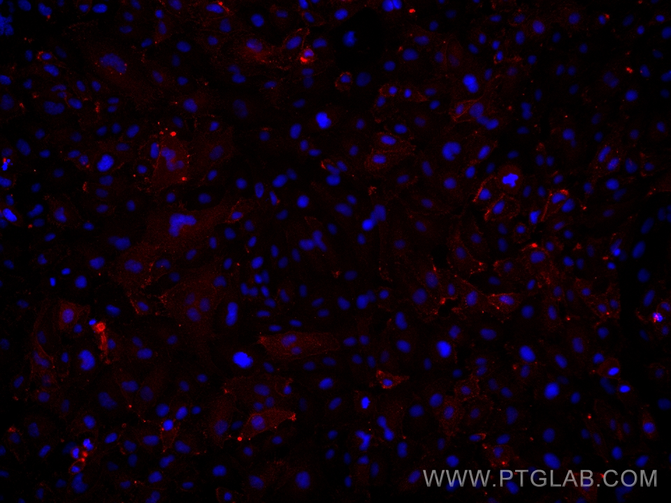 Immunofluorescence (IF) / fluorescent staining of HUVEC cells using ICAM2/CD102 Monoclonal antibody (67628-1-Ig)