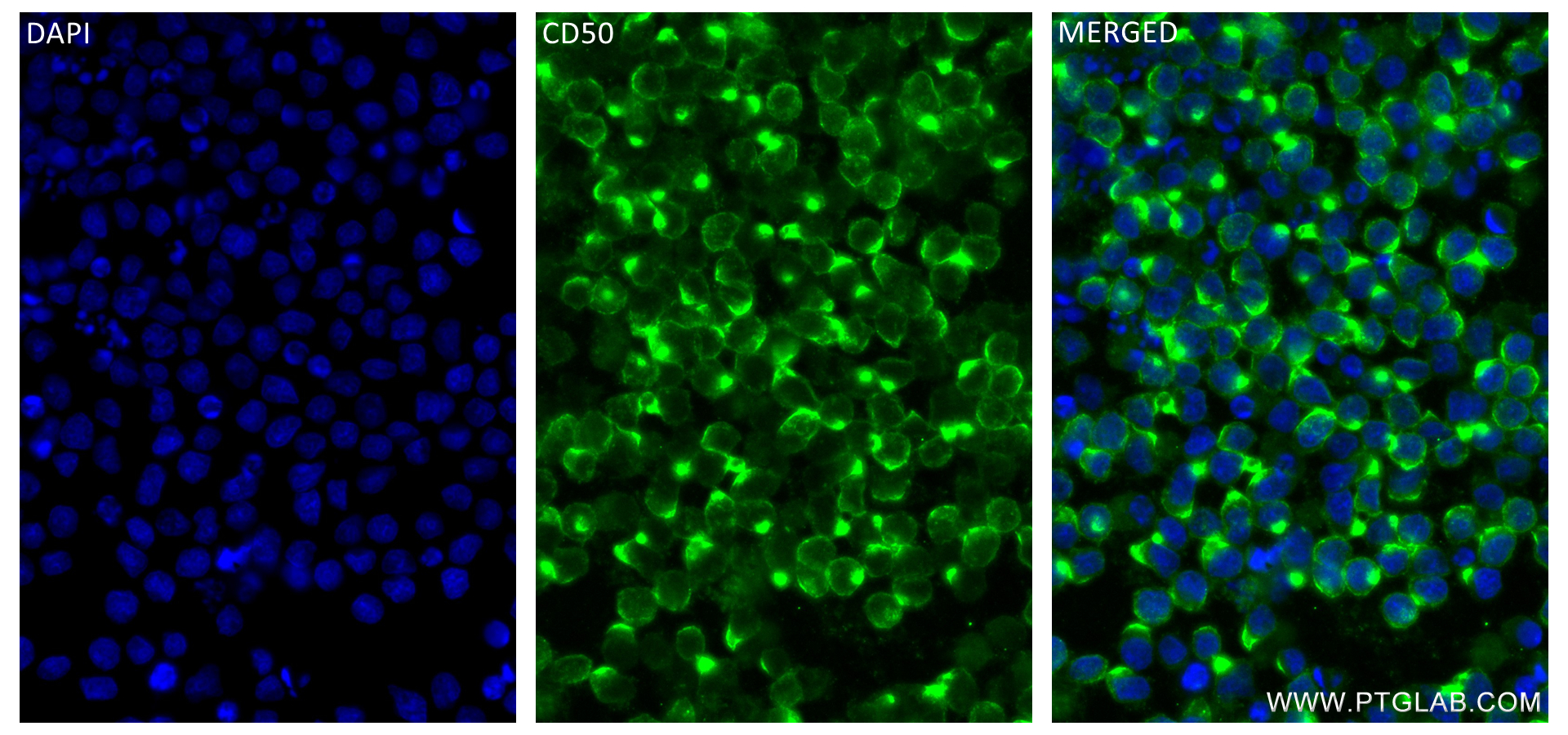 Immunofluorescence (IF) / fluorescent staining of Ramos cells using ICAM3/CD50 Recombinant antibody (84335-3-RR)