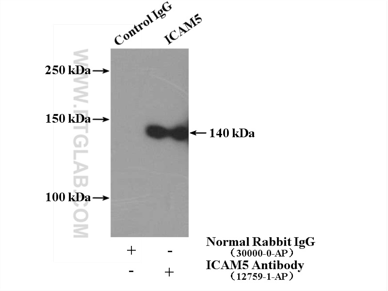 ICAM5