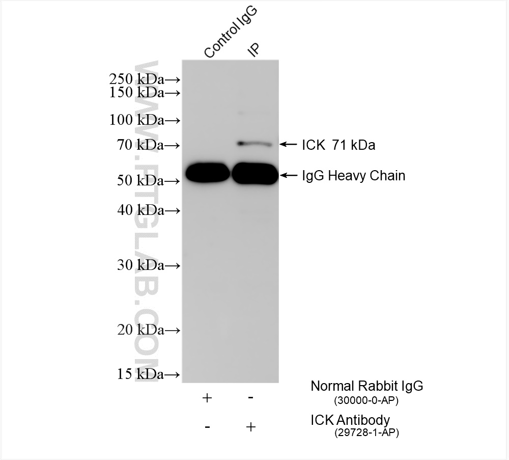 Immunoprecipitation (IP) experiment of PC-3 cells using ICK Polyclonal antibody (29728-1-AP)