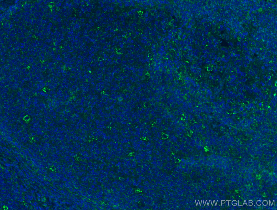 Immunofluorescence (IF) / fluorescent staining of human tonsillitis tissue using ICOS Polyclonal antibody (13338-1-AP)