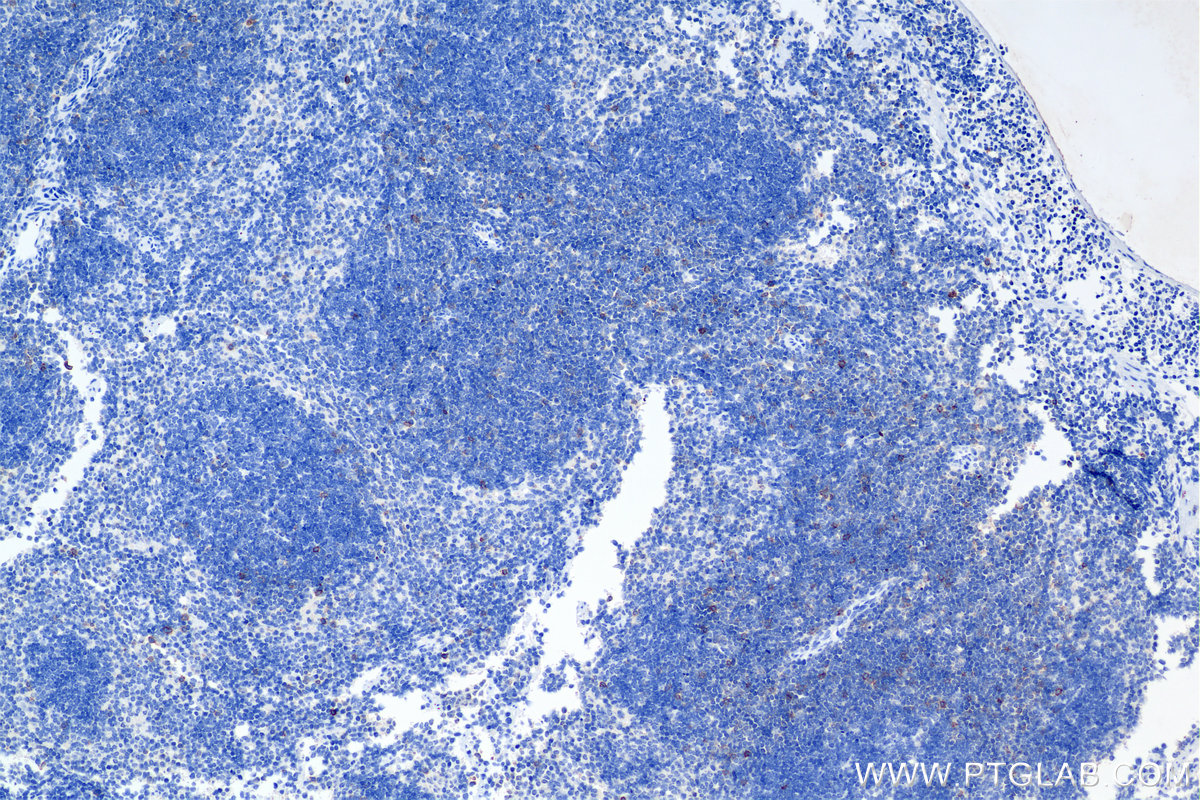 Immunohistochemistry (IHC) staining of mouse spleen tissue using ICOS/CD278 Recombinant monoclonal antibody (85035-2-RR)