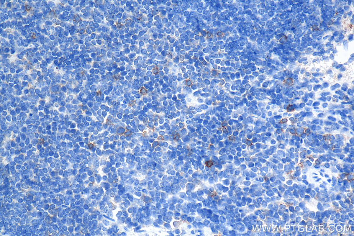 Immunohistochemistry (IHC) staining of mouse spleen tissue using ICOS/CD278 Recombinant monoclonal antibody (85035-2-RR)