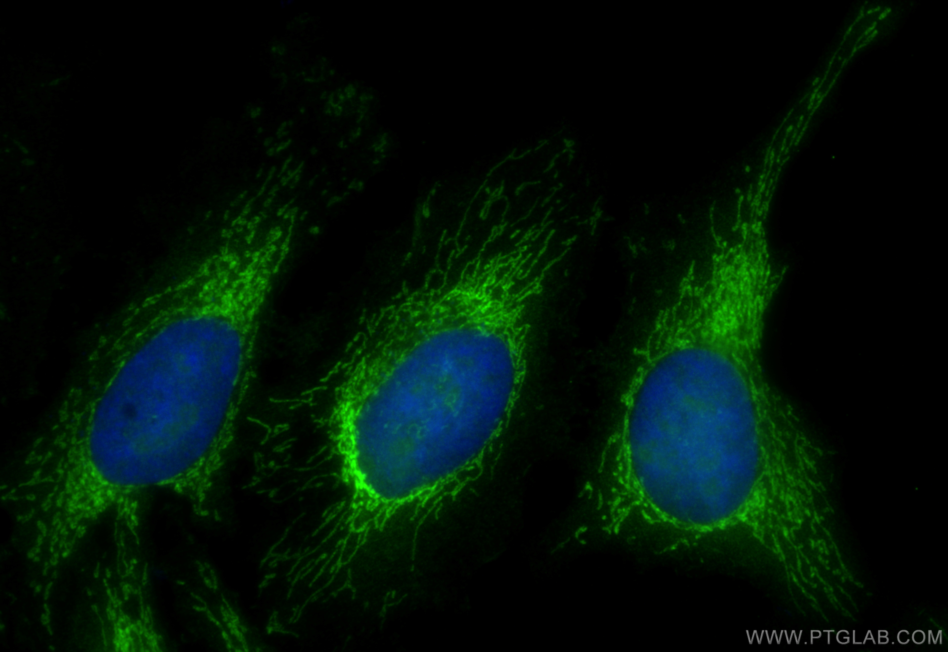 Immunofluorescence (IF) / fluorescent staining of HeLa cells using ICT1 Polyclonal antibody (10403-1-AP)