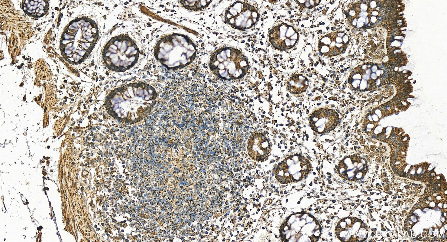 Immunohistochemistry (IHC) staining of human colon tissue using IDH3G Polyclonal antibody (25848-1-AP)