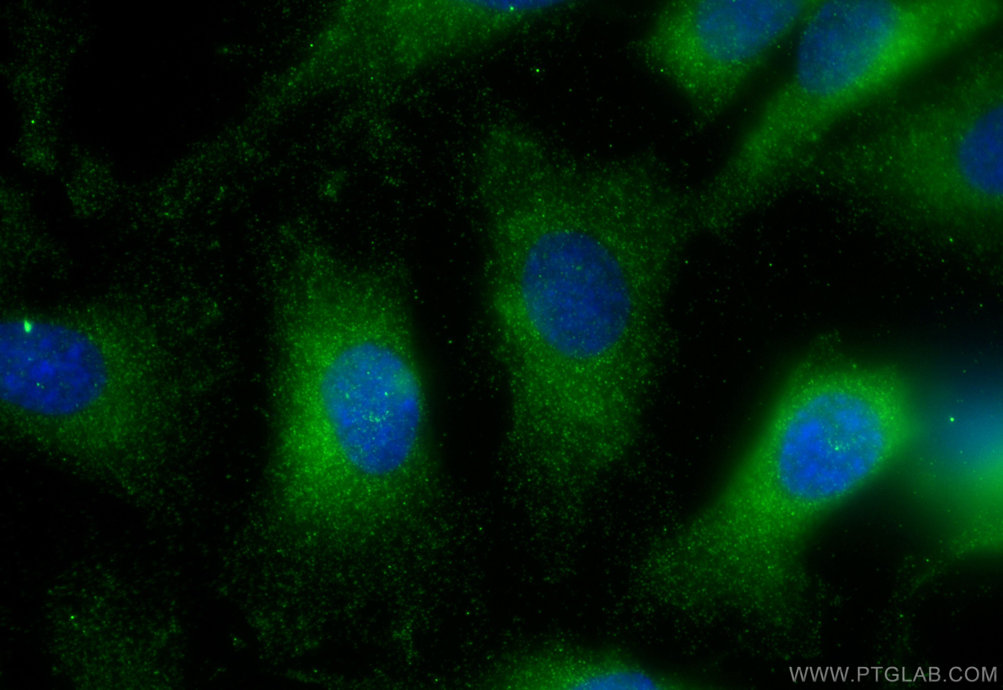 Immunofluorescence (IF) / fluorescent staining of SKOV-3 cells using IDO1 Polyclonal antibody (13268-1-AP)