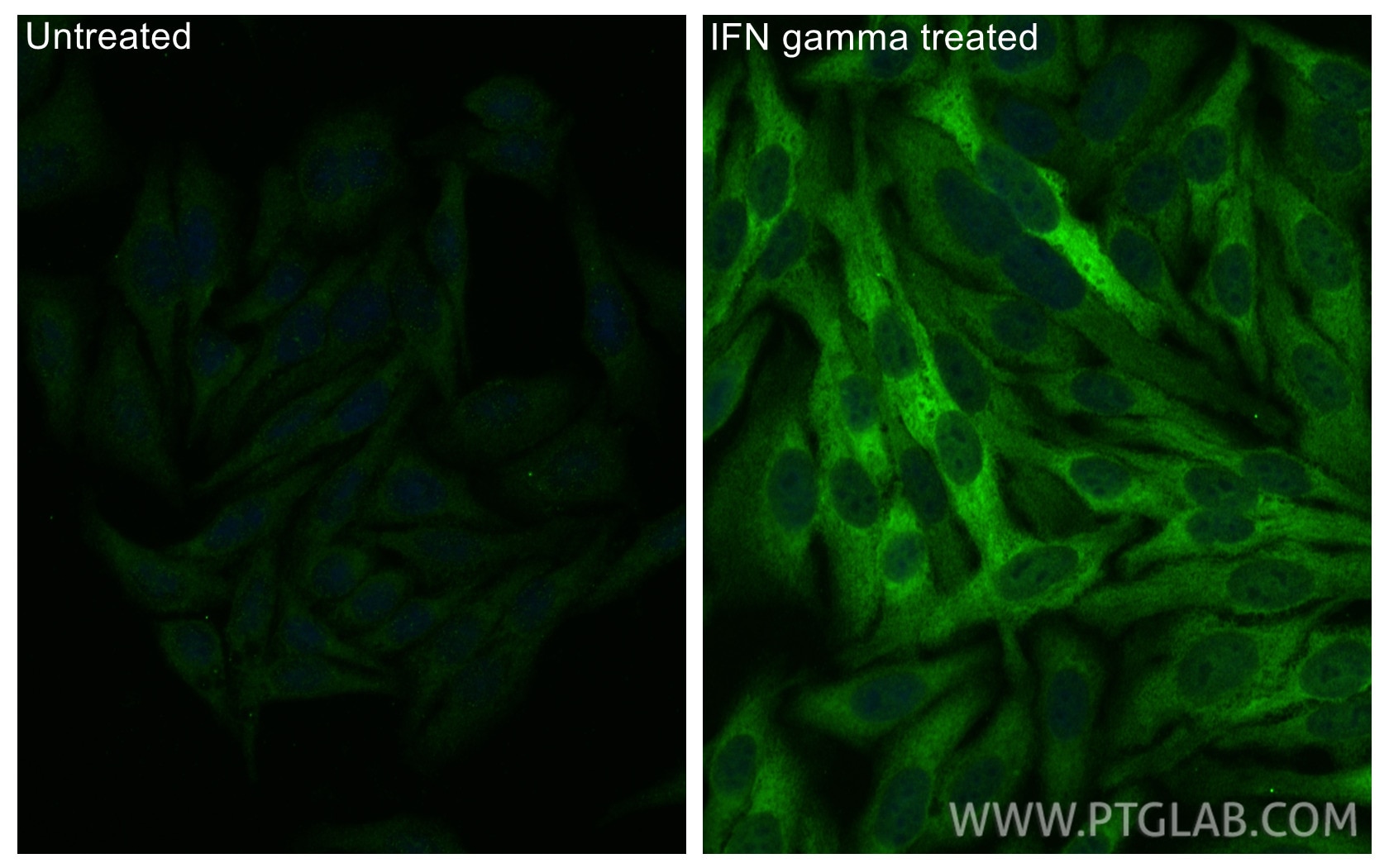 Immunofluorescence (IF) / fluorescent staining of HepG2 cells using IDO1 Polyclonal antibody (13268-1-AP)