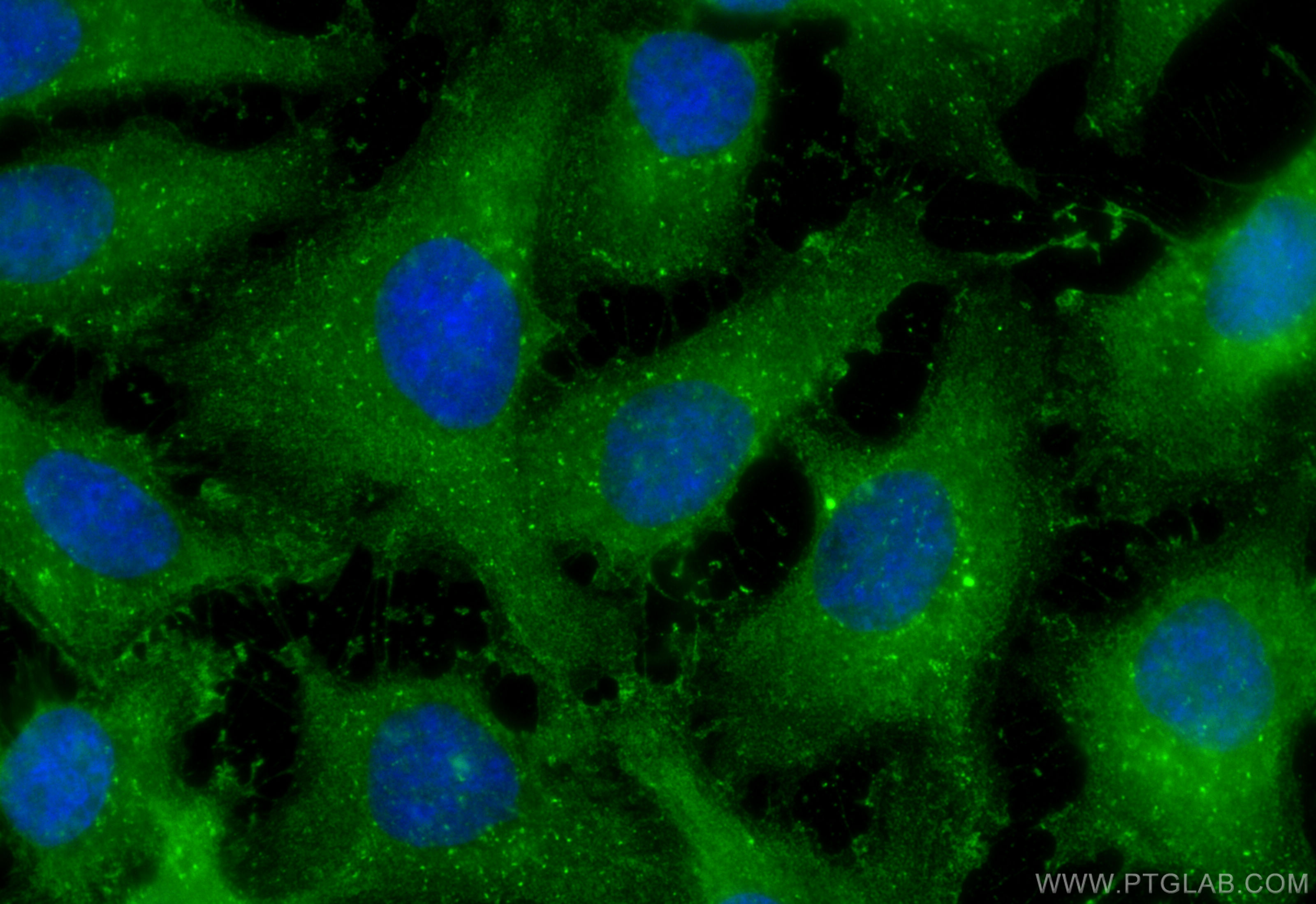 Immunofluorescence (IF) / fluorescent staining of SKOV-3 cells using IDO1 Monoclonal antibody (66528-1-Ig)