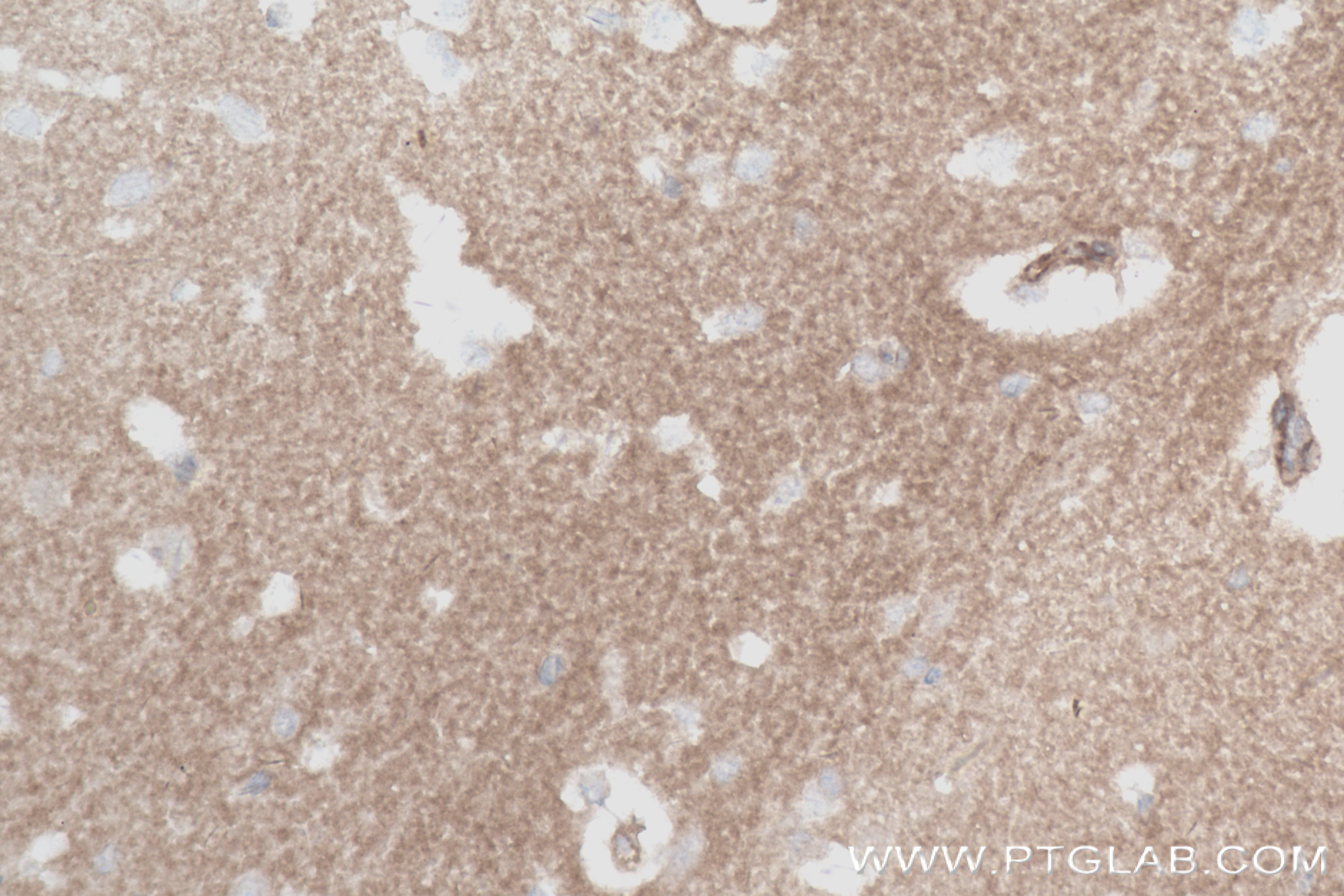 Immunohistochemistry (IHC) staining of mouse brain tissue using IDO1 Recombinant antibody (84063-3-RR)