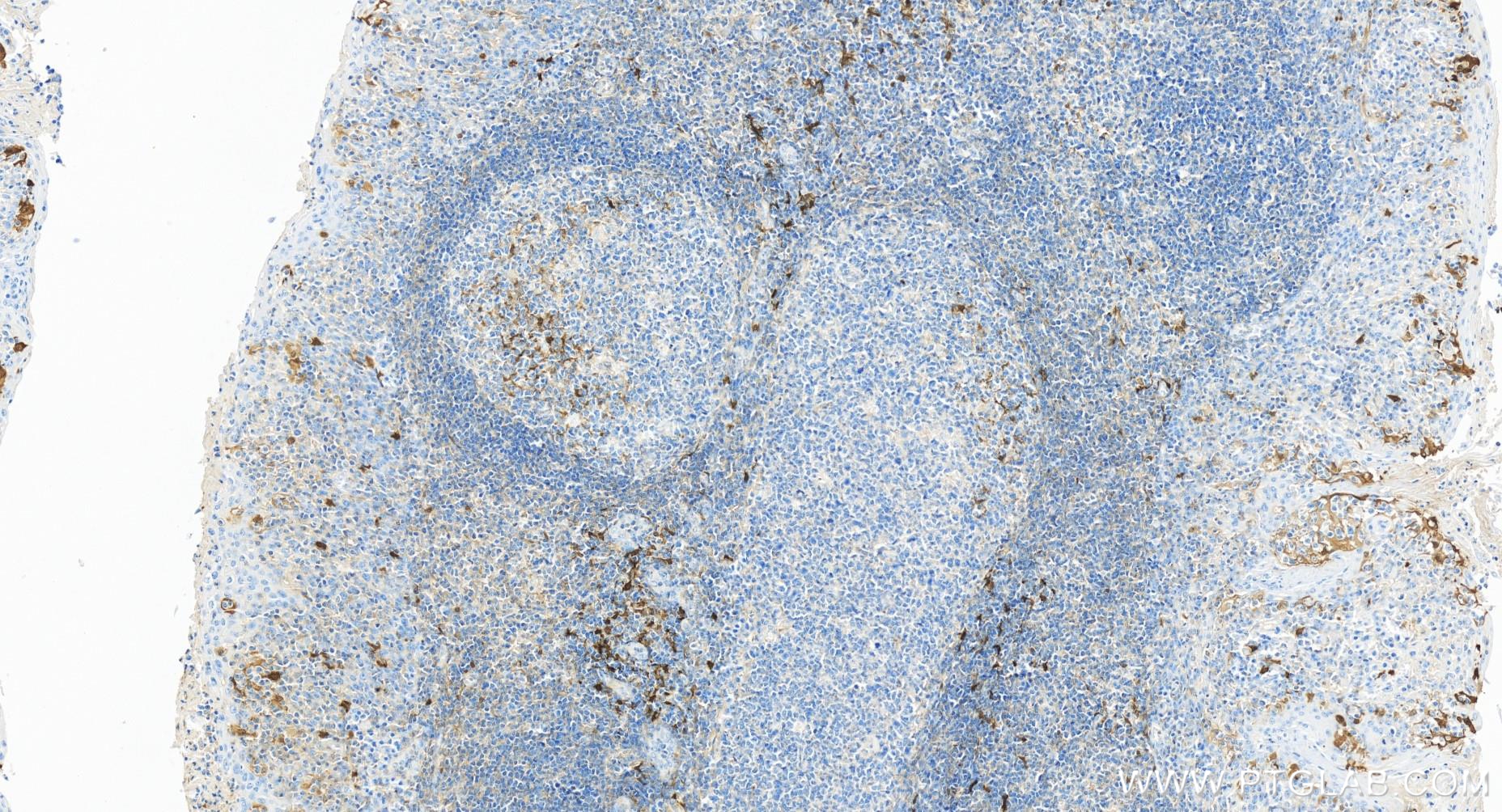 Immunohistochemistry (IHC) staining of human tonsillitis tissue using IDO1 Recombinant antibody (84063-3-RR)