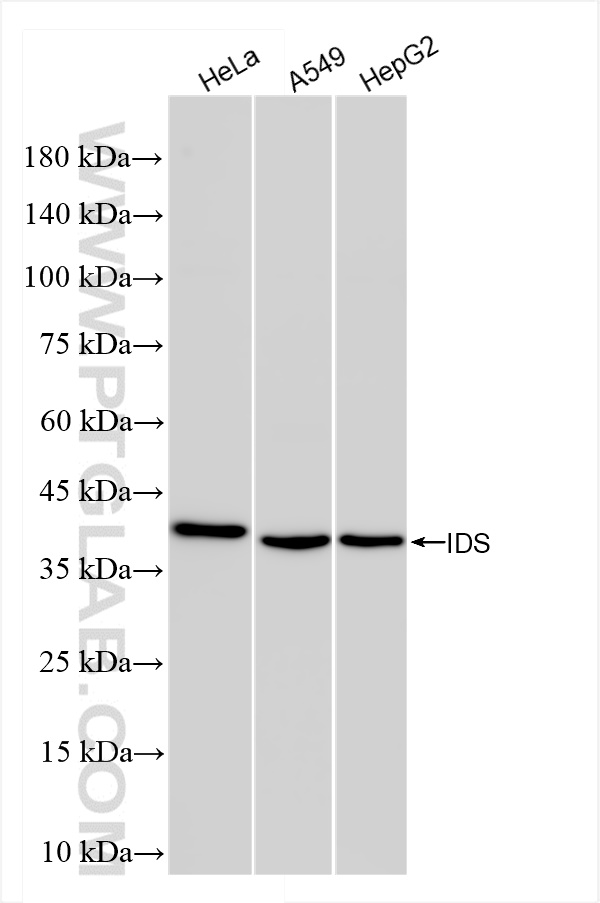 Western Blot (WB) analysis of various lysates using IDS Recombinant antibody (84623-6-RR)