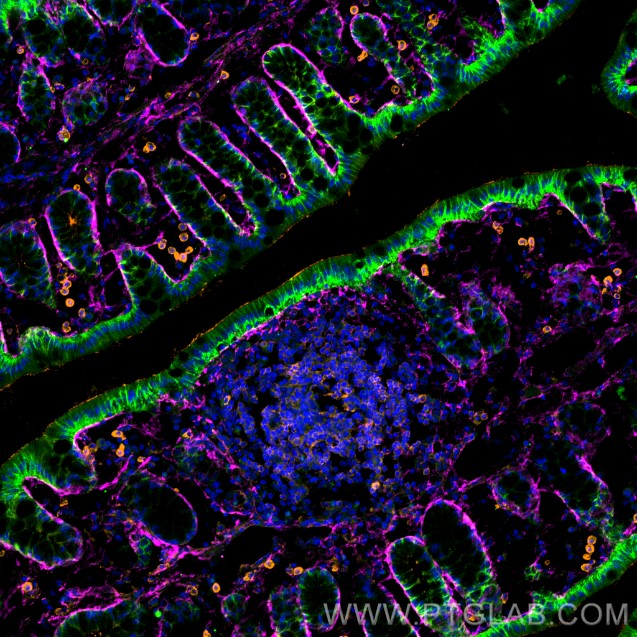 Immunofluorescence of mouse colon: Frozen OCT-embedded mouse colon sections were stained with anti-E-cadherin antibody (20874-1-AP) labeled with CoraLite® 488-Conjugated AffiniPure Goat Anti-Rabbit IgG(H+L) (SA00013-2, green) in frist step, anti-CD45 antibody (80297-1-RR) labeled 
with CoraLite® Plus 555 (KFA002, orange) in sencond step, anti-Collagen Type III antibody (22734-1-AP) labeled with FlexAble CoraLite® 647 Kit (KFA003, magenta) in the third step, and DAPI (blue).