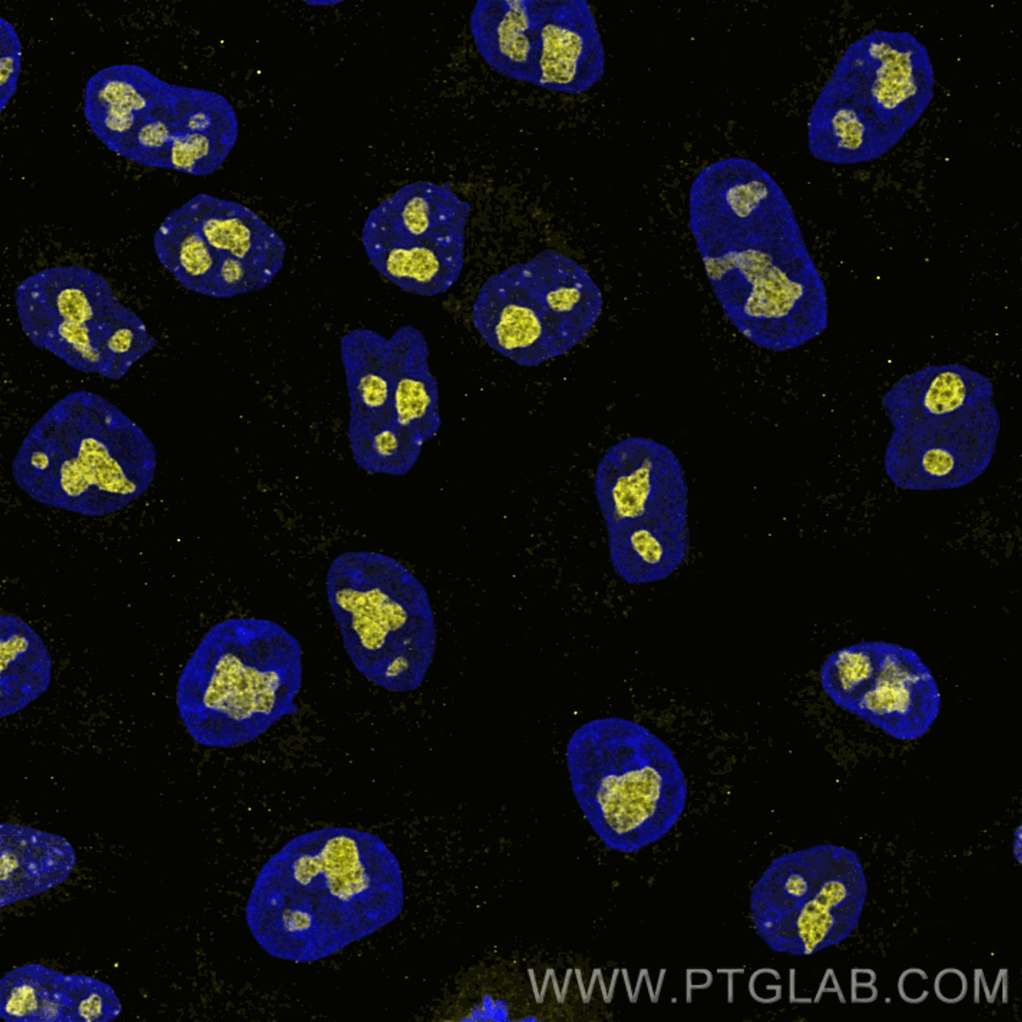 Immunofluorescence of HeLa: PFA-fixed HeLa cells were stained with anti-GNL3 antibody (67169-1-lg) labeled with  FlexAble Biotin Antibody Labeling Kit for Mouse IgG2a (KFA047) and Streptavidin-ATTO594​ (yellow). Nuclei are stained with DAPI (blue). Confocal images were acquired with a 100x oil objective and post-processed. Images were recorded at the Core Facility Bioimaging at the Biomedical Center, LMU Munich.