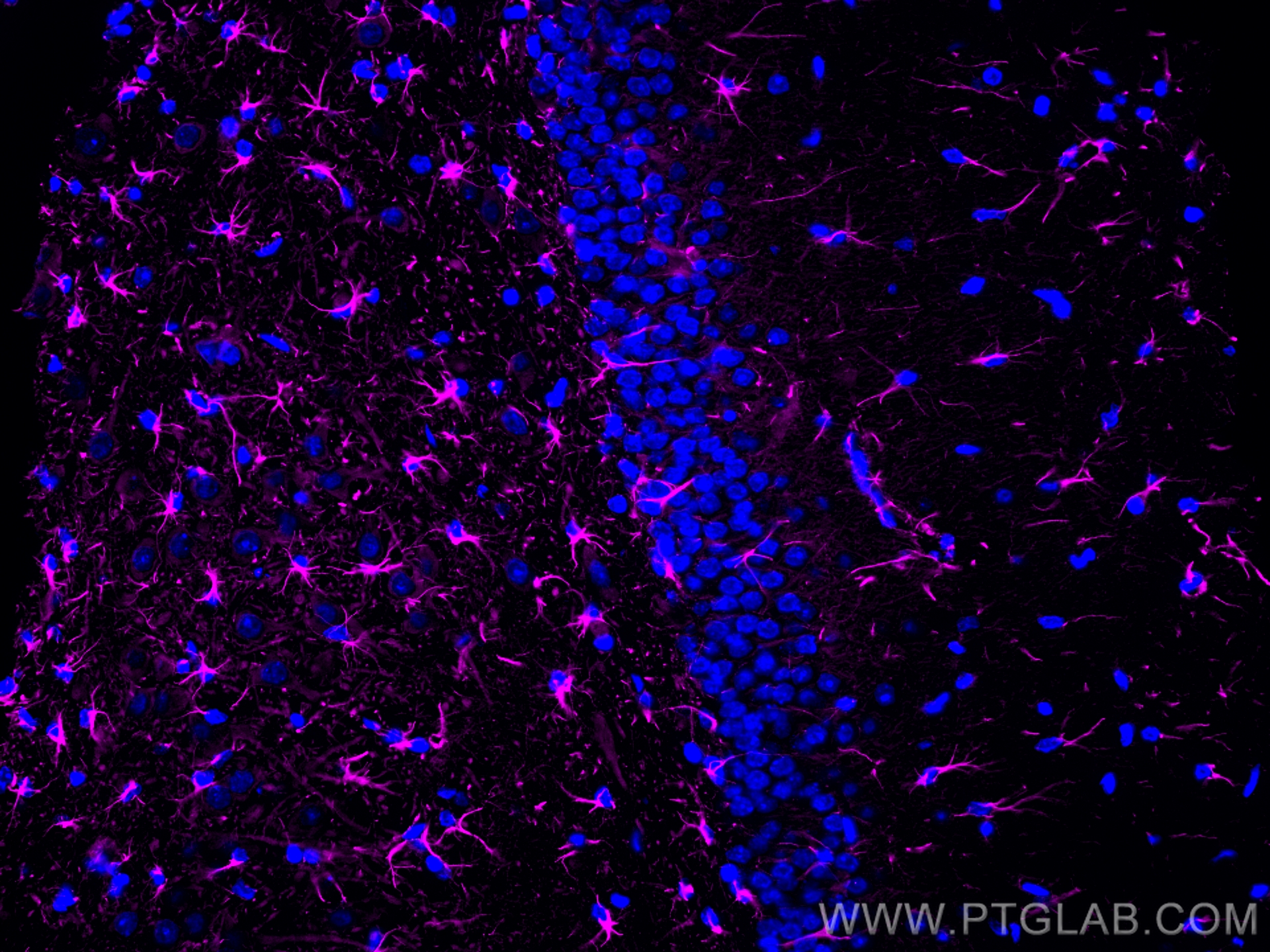 Immunofluorescence of rat brain: FFPE rat brain sections were stained with anti-GFAP antibody (60190-1-Ig) labeled with FlexAble Biotin Antibody Labeling Kit for Mouse IgG2a (KFA047) and Streptavidin-650 (magenta).  Cell nuclei are in blue.
