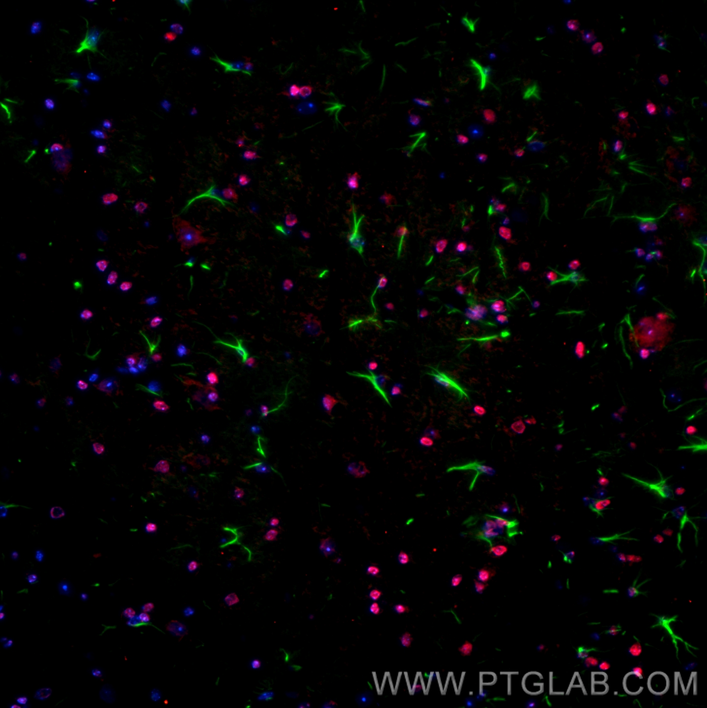 Immunofluorescence of mouse cerebellum: FFPE mouse cerebellum sections were stained with anti-GFAP antibody (60190-1-Ig) labeled with FlexAble Biotin Antibody Labeling Kit for Mouse IgG2a (KFA047) and Streptavidin-488 (green),  and anti-SOX10 antibody (66786-1-Ig) labeled with FlexAble Biotin Antibody Labeling Kit for Mouse IgG2a (KFA047) and Streptavidin-594 (red). Cell nuclei are stained with DAPI (blue).