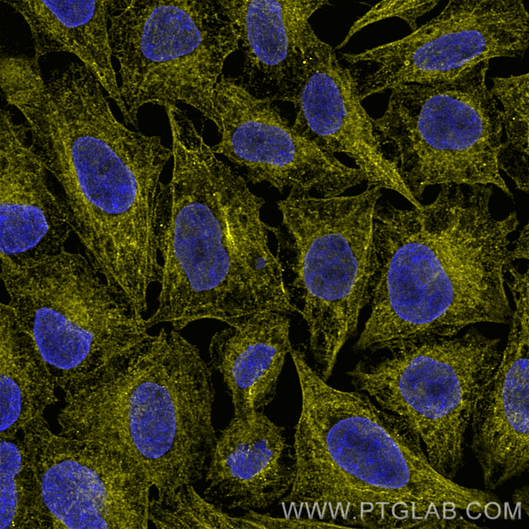 Immunofluorescence of HeLa: PFA-fixed HeLa cells were stained with anti-Tubulin β antibody labeled with FlexAble Biotin Antibody Labeling Kit for Mouse IgG2b (KFA067) and Streptavidin-ATTO594​ (yellow). Nuclei are stained with DAPI (blue). Confocal images were acquired with a 100x oil objective and post-processed. Images were recorded at the Core Facility Bioimaging at the Biomedical Center, LMU Munich.