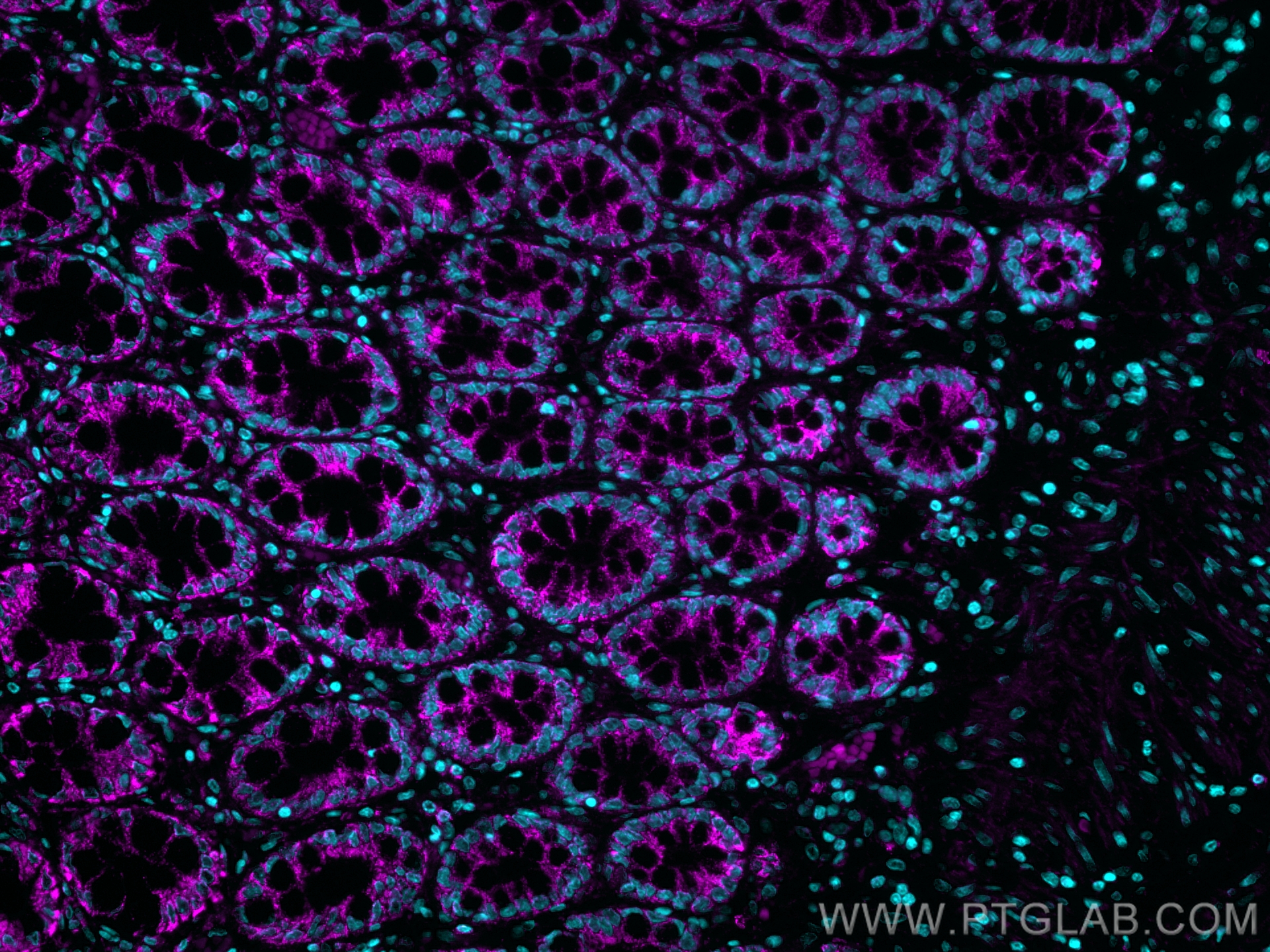 Immunofluorescence of human colon: FFPE human colon sections were stained with anti-KRT20 antibody (60183-1-Ig) labeled with FlexAble Biotin Antibody Labeling Kit for Mouse IgG2b (KFA067) and Streptavidin-650 (magenta). Cell nuclei are in blue.