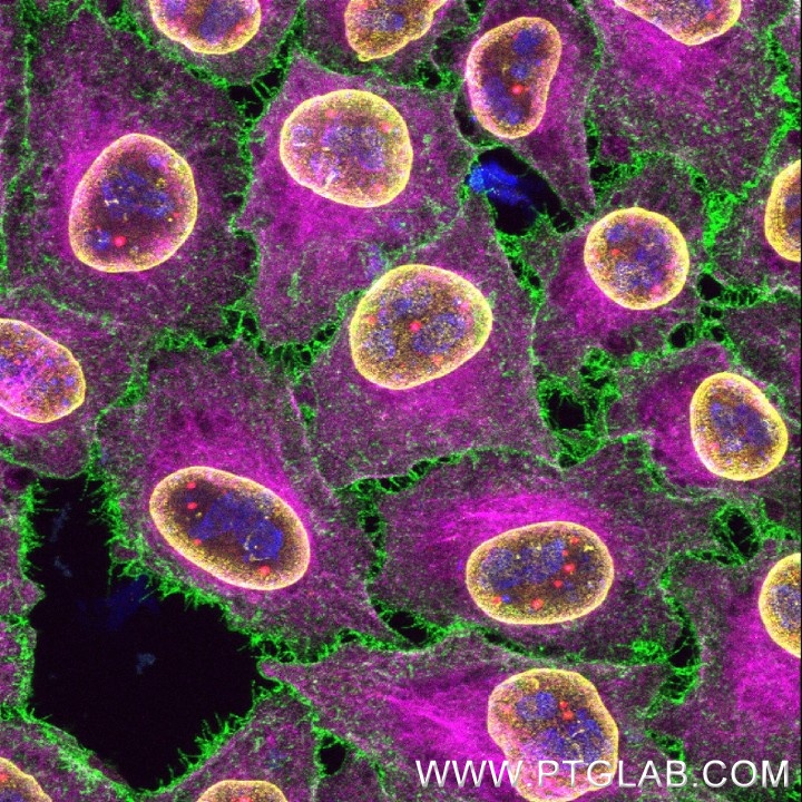Immunofluorescence of HeLa cells with 5 rabbit primary antibodies: PFA-fixed cells were stained with anti-Ki-67 antibody (MA5-14520, blue) labeled with FlexAble 2.0 CoraLite® Plus 405 Kit (KFA506), anti-CD147 antibody (11989-1-AP, green) labeled with FlexAble 2.0 CoraLite® Plus 488 Kit (KFA501), anti-Lamin B1 antibody (12987-1-AP, yellow) labeled with FlexAble 2.0 CoraLite® Plus 555 Kit (KFA502), anti-Coilin antibody (10967-1-AP, red) labeled with FlexAble 2.0 CoraLite® Plus 647 Kit (KFA503), and anti-Tubulin antibody (80713-1-RR, magenta) labeled with FlexAble 2.0 CoraLite® Plus 800 Kit. Confocal Images were acquired with a 60x oil objective and post-processed. Immunofluorescence of HeLa cells with 5 rabbit primary antibodies: PFA-fixed cells were stained with anti-Ki-67 antibody (MA5-14520, blue) labeled with FlexAble 2.0 CoraLite® Plus 405 Kit (KFA506), anti-CD147 antibody (11989-1-AP, green) labeled with FlexAble 2.0 CoraLite® Plus 488 Kit (KFA501), anti-Lamin B1 antibody (12987-1-AP, yellow) labeled with FlexAble 2.0 CoraLite® Plus 555 Kit (KFA502), anti-Coilin antibody (10967-1-AP, red) labeled with FlexAble 2.0 CoraLite® Plus 647 Kit (KFA503), and anti-Tubulin antibody (80713-1-RR, magenta) labeled with FlexAble 2.0 CoraLite® Plus 800 Kit. Confocal Images were acquired with a 60x oil objective and post-processed.