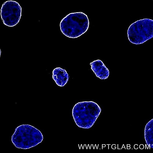 Immunofluorescence of Hela cells: PFA-fixed cells were stained with rabbit IgG anti-Lamin antibody (12987-1-AP) labeled with FlexAble 2.0 CoraLite® Plus 750 Kit (KFA504, grey). Cell nuclei were stained with DAPI (blue). 

Confocal images were acquired with a 63x oil objective and post-processed. Images were recorded at the Core Facility Bioimaging at the Biomedical Center, LMU Munich.