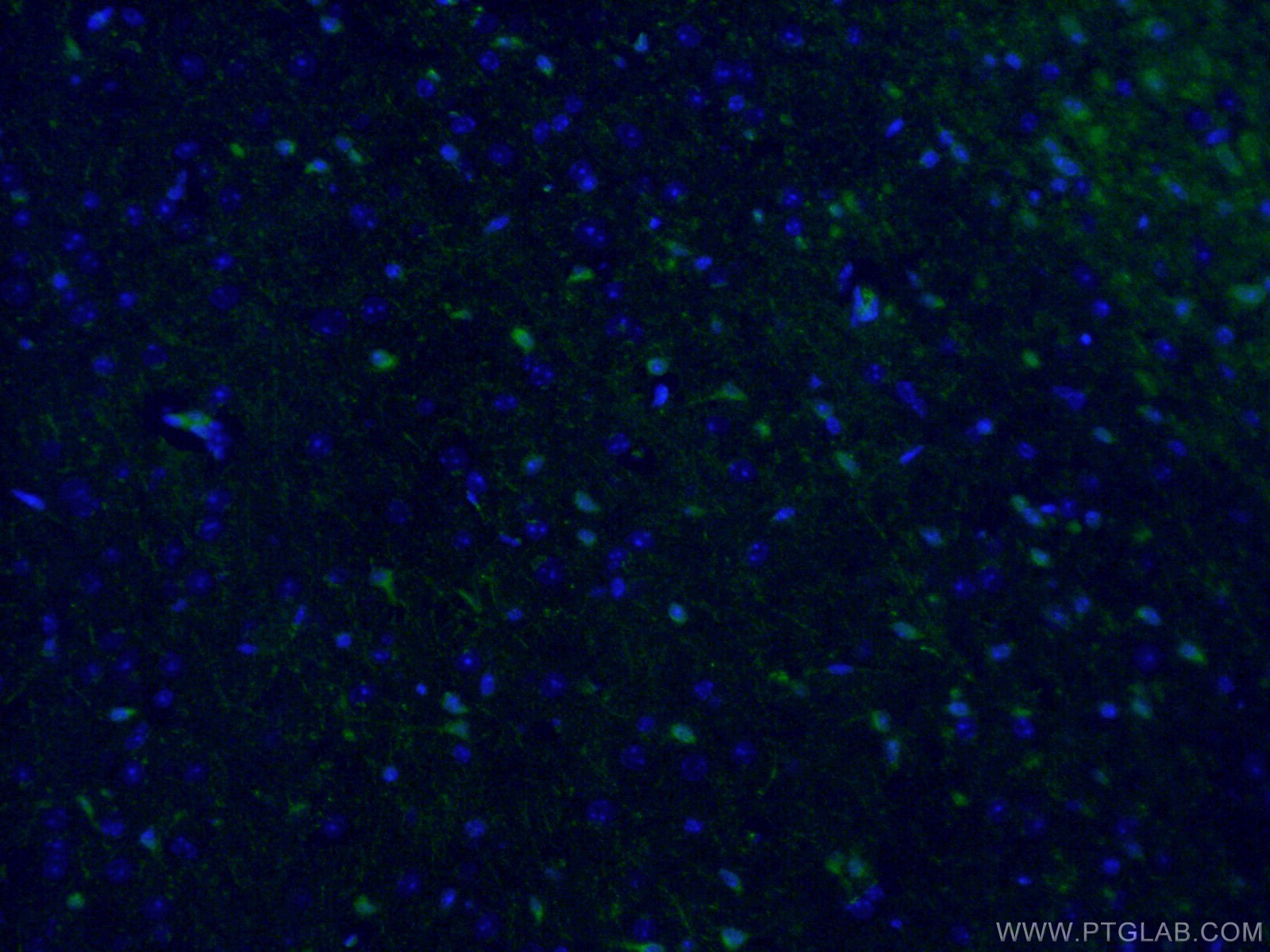 Immunofluorescent analysis of (4% PFA) fixed mouse brain tissue using 26276-1-AP (ATG9A antibody) at dilution of 1:50 and Alexa Fluor 488-Conjugated AffiniPure Goat Anti-Rabbit IgG(H+L).