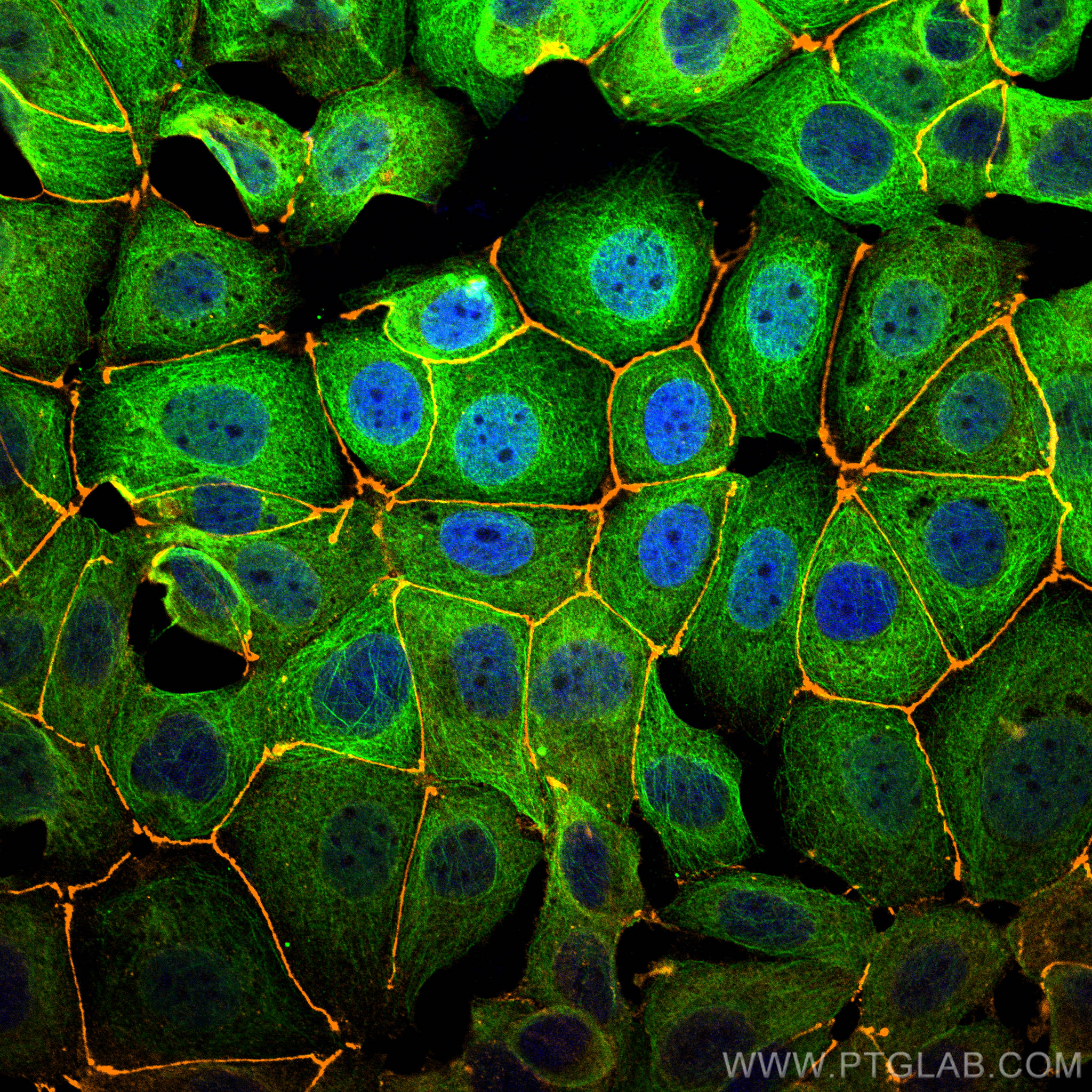 Immunofluorescence of MCF-7 cells: MCF-7 cells were fixed with 4% PFA and stained with Rabbit anti-ZO1 polyclonal antibody (21773-1-AP, 1:2000, orange) and mouse anti-Alpha Tubulin monoclonal antibody (66031-1-Ig, 1:1000, green). Multi-rAb CoraLite® Plus 555-Goat Anti-Rabbit Recombinant Secondary Antibody (H+L) (RGAR003, 1:500) and Multi-rAb CoraLite® Plus 488-Goat Anti-Mouse Recombinant Secondary Antibody (H+L) (RGAM002, 1:500) were used for detection