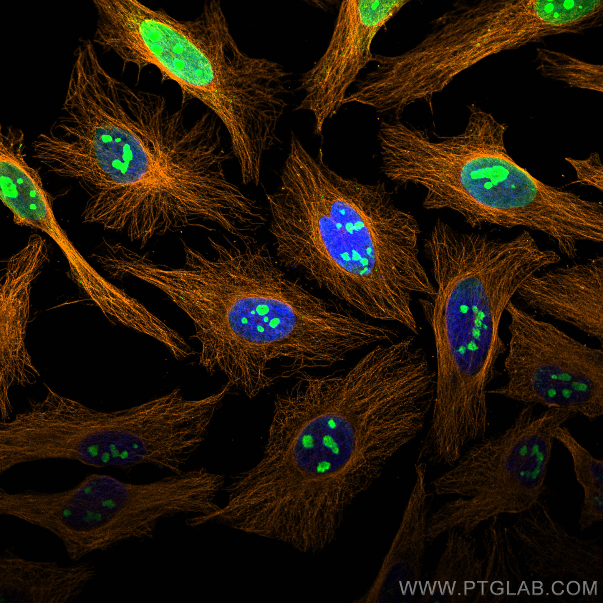 Immunofluorescence of Hela cells: Hela cells were fixed with 4% PFA and stained with Rabbit anti-Alpha Tubulin polyclonal antibody (11224-1-AP, 1:200, orange) and mouse anti-NPM1 monoclonal antibody (60096-1-Ig, 1:1000, green). Multi-rAb CoraLite® Plus 555-Goat Anti-Rabbit Recombinant Secondary Antibody (H+L) (RGAR003, 1:500) and Multi-rAbCoraLite® Plus 488-Goat Anti-Mouse Recombinant Secondary Antibody (H+L) (RGAM002, 1:500) were used for detection.