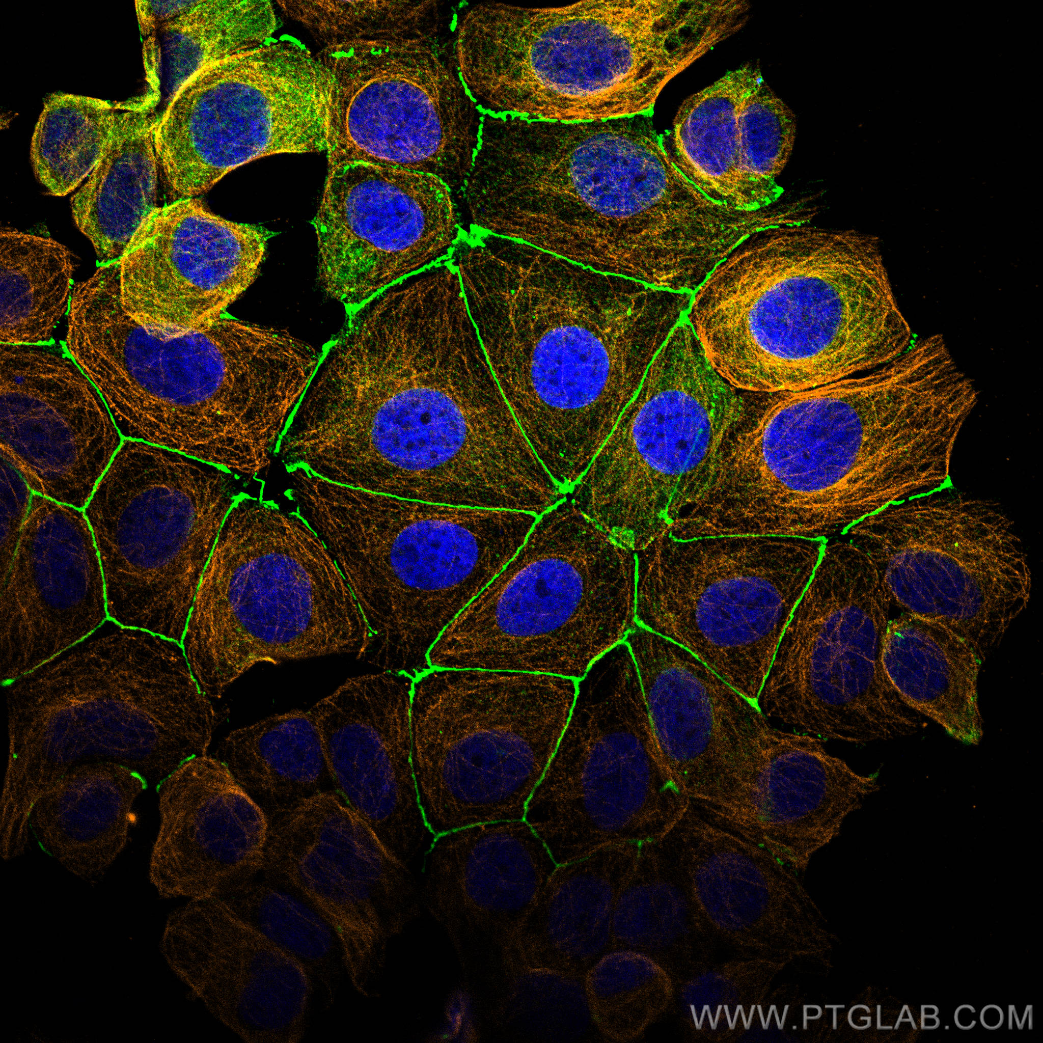 Immunofluorescence of MCF-7 cells: MCF-7 cells were fixed with 4% PFA and stained with Rabbit anti-ZO1 polyclonal antibody (21773-1-AP, 1:2000, green) and mouse anti-Alpha Tubulin monoclonal antibody (66031-1-Ig, 1:1000, orange). Multi-rAb CoraLite® Plus 488-Goat Anti-Rabbit Recombinant Secondary Antibody (H+L) (RGAR002, 1:500) and Multi-rAb CoraLite® Plus 555-Goat Anti-Mouse Recombinant Secondary Antibody (H+L) (RGAM003, 1:500) were used for detection. 