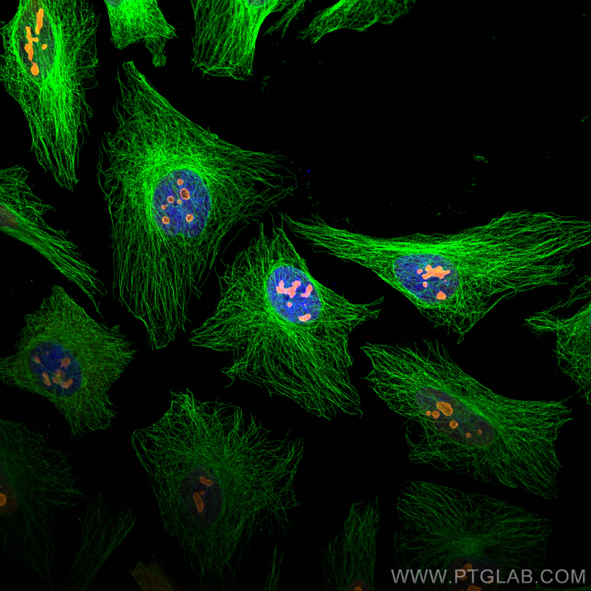 Immunofluorescence of Hela cells: Hela cells were fixed with 4% PFA and stained with Rabbit anti-Alpha Tubulin polyclonal antibody (11224-1-AP, 1:200, green) and mouse anti-NPM1 monoclonal antibody (60096-1-Ig, 1:1000, orange). Multi-rAb CoraLite® Plus 488-Goat Anti-Rabbit Recombinant Secondary Antibody (H+L) (RGAR002, 1:500) and Multi-rAb CoraLite® Plus 555-Goat Anti-Mouse Recombinant Secondary Antibody (H+L) (RGAM003, 1:500) were used for detection. 