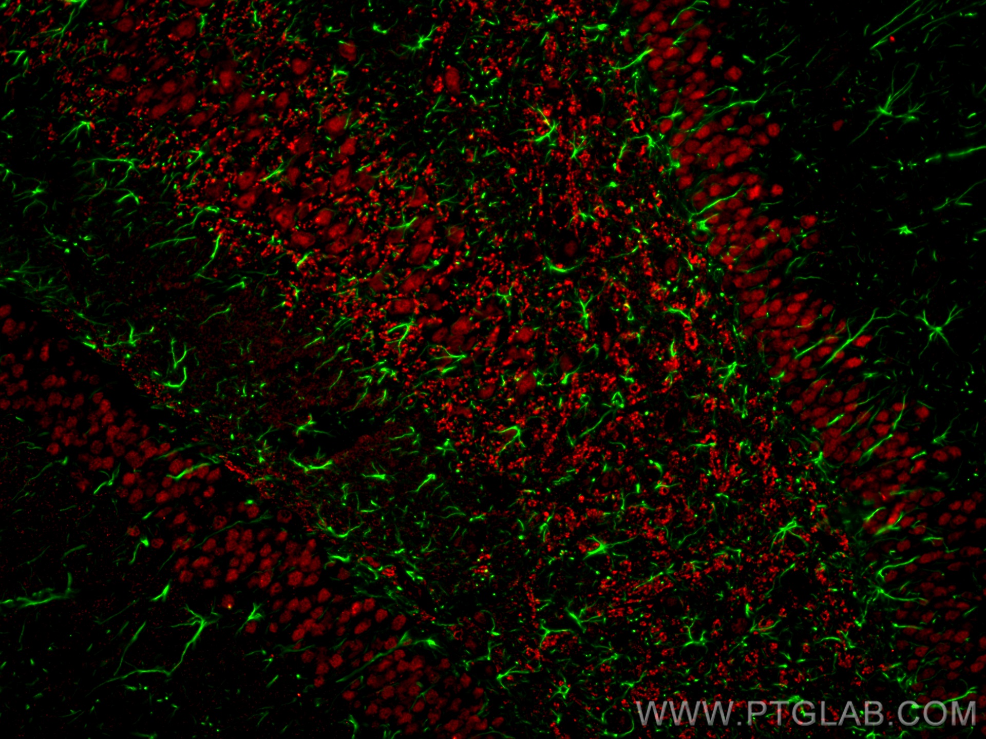 Immunofluorescence of rat brain: rat brain FFPE section was stained with Rabbit anti-GFAP polyclonal antibody (16825-1-AP, 1:200, green) and mouse anti-NeuN monoclonal antibody (66836-1-Ig, red). Multi-rAb CoraLite® Plus 488 conjugated Recombinant Goat anti-rabbit secondary antibody (RGAR002, 1:500) and Multi-rAb CoraLite® Plus 594 conjugated Goat Anti-Mouse Recombinant Secondary Antibody (H+L) were used for detection (RGAM004, 1:500) . 