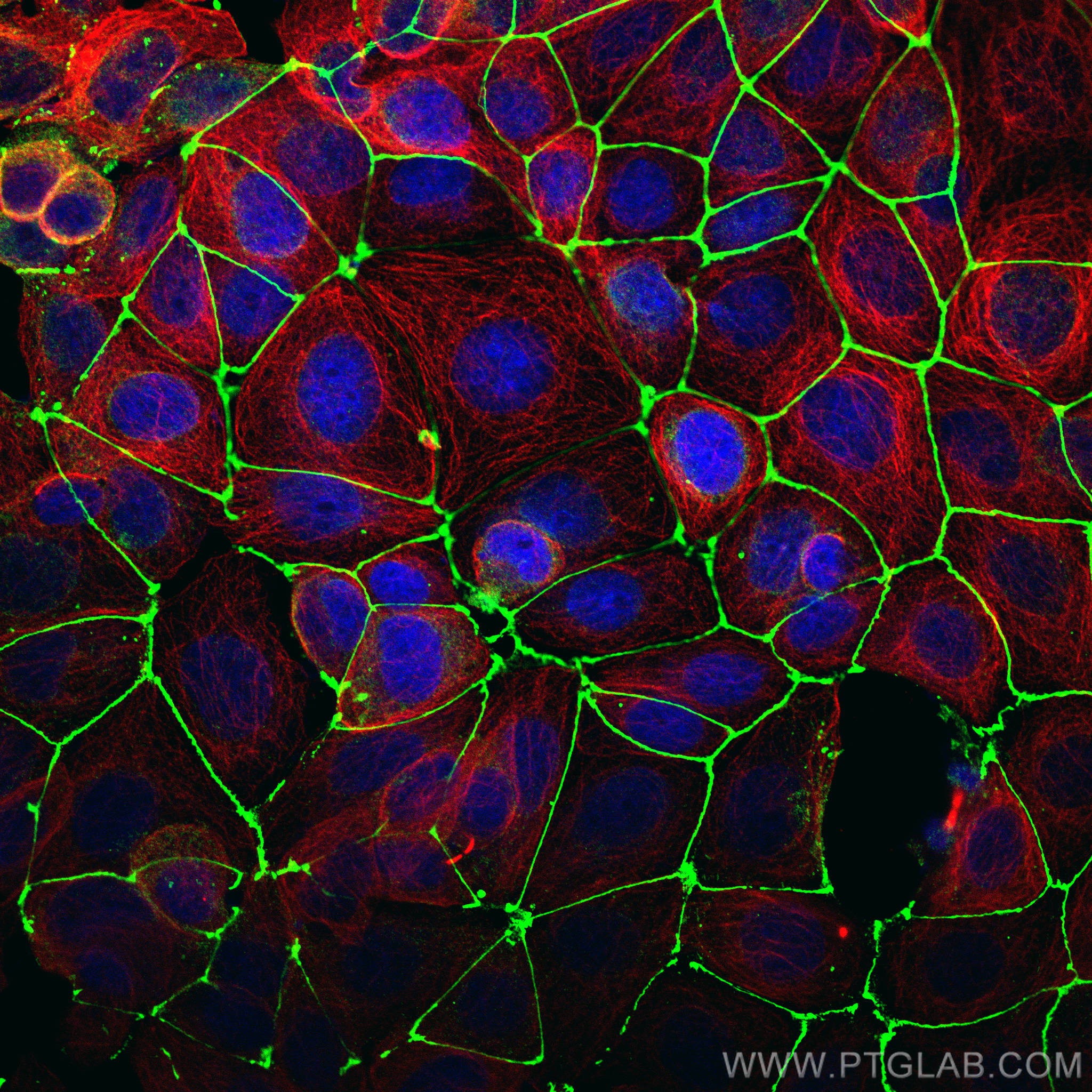 Immunofluorescence of MCF-7 cells: MCF-7 cells were fixed with 4% PFA and stained with Rabbit anti-ZO1 polyclonal antibody (21773-1-AP, 1:2000, green) and mouse anti-Alpha Tubulin monoclonal antibody (66031-1-Ig, 1:1000, red). Multi-rAb CoraLite® Plus 488-Goat Anti-Rabbit Recombinant Secondary Antibody (H+L) (RGAR002, 1:500) and Multi-rAb CoraLite® Plus 594-Goat Anti-Mouse Recombinant Secondary Antibody (H+L) (RGAM004, 1:500) were used for detection. 