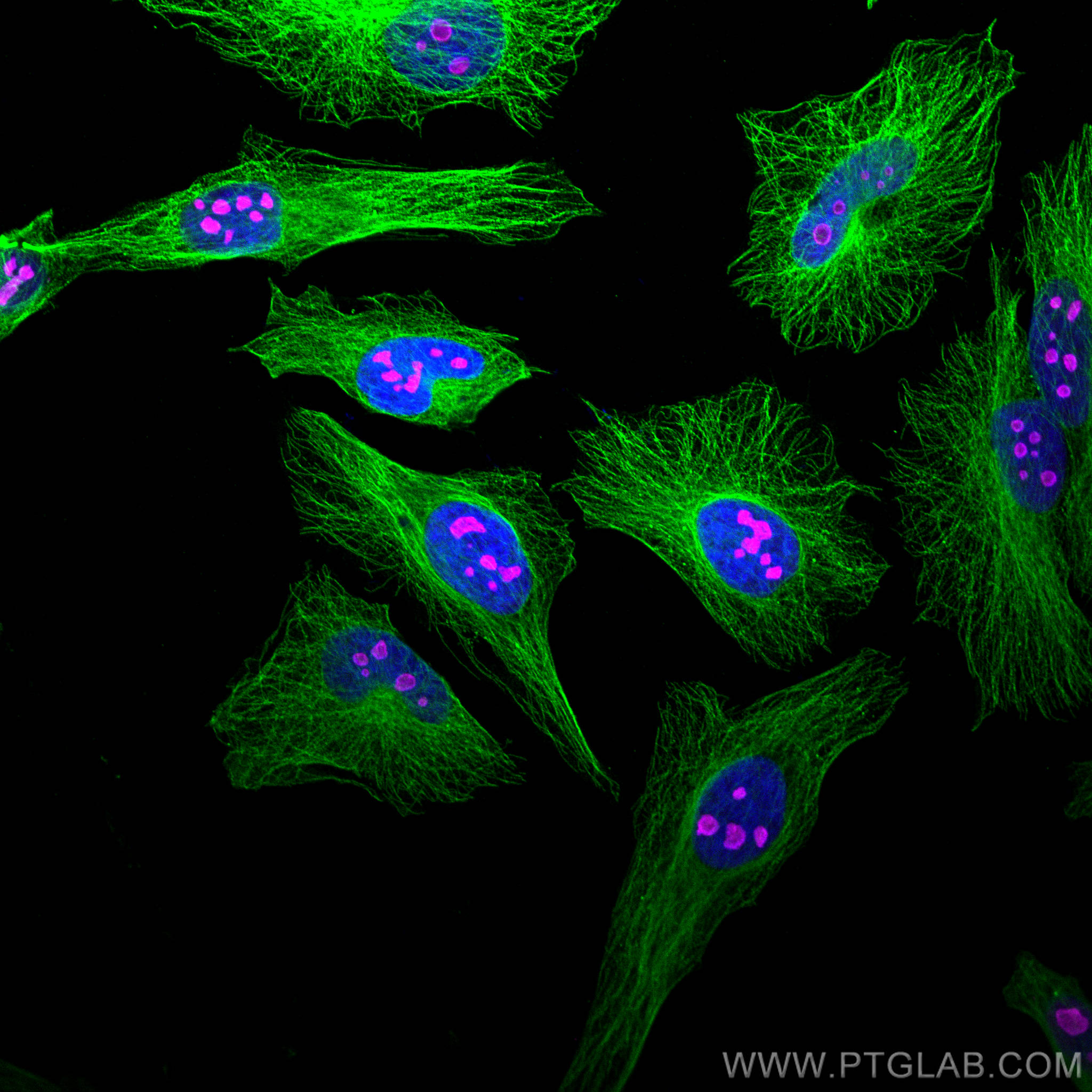Immunofluorescence of Hela cells: Hela cells were fixed with 4% PFA and stained with Rabbit anti-Alpha Tubulin polyclonal antibody (11224-1-AP, 1:200, green) and mouse anti-NPM1 monoclonal antibody (60096-1-Ig, 1:1000, magenta). Multi-rAb CoraLite® Plus 488-Goat Anti-Rabbit Recombinant Secondary Antibody (H+L) (RGAR002, 1:500) and Multi-rAb CoraLite® Plus 647-Goat Anti-Mouse Recombinant Secondary Antibody (H+L) (RGAM005, 1:500) were used for detection. 