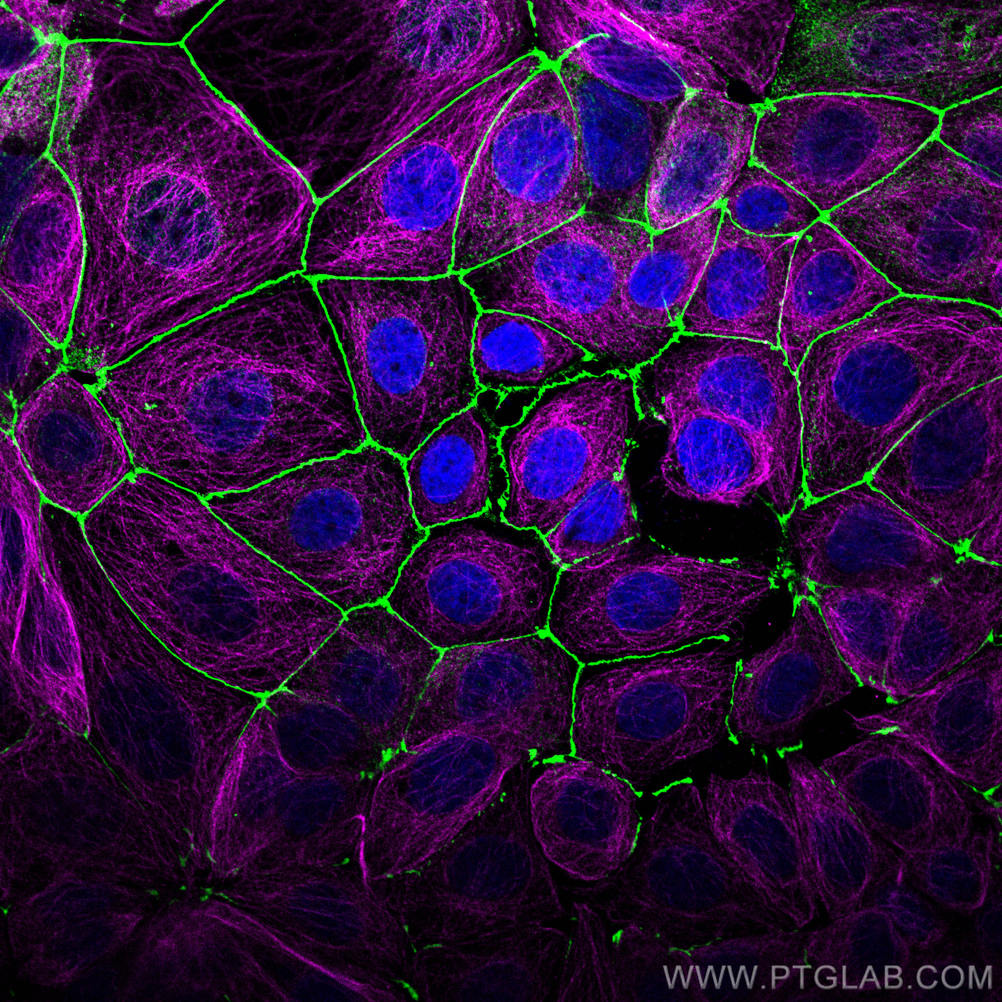 Immunofluorescence of MCF-7 cells: MCF-7 cells were fixed with 4% PFA and stained with Rabbit anti-ZO1 polyclonal antibody (21773-1-AP, 1:2000, green) and mouse anti-Alpha Tubulin monoclonal antibody (66031-1-Ig, 1:1000, magenta). Multi-rAb CoraLite® Plus 488-Goat Anti-Rabbit Recombinant Secondary Antibody (H+L) (RGAR002, 1:500) and Multi-rAb CoraLite® Plus 647-Goat Anti-Mouse Recombinant Secondary Antibody (H+L) (RGAM005, 1:500) were used for detection. 