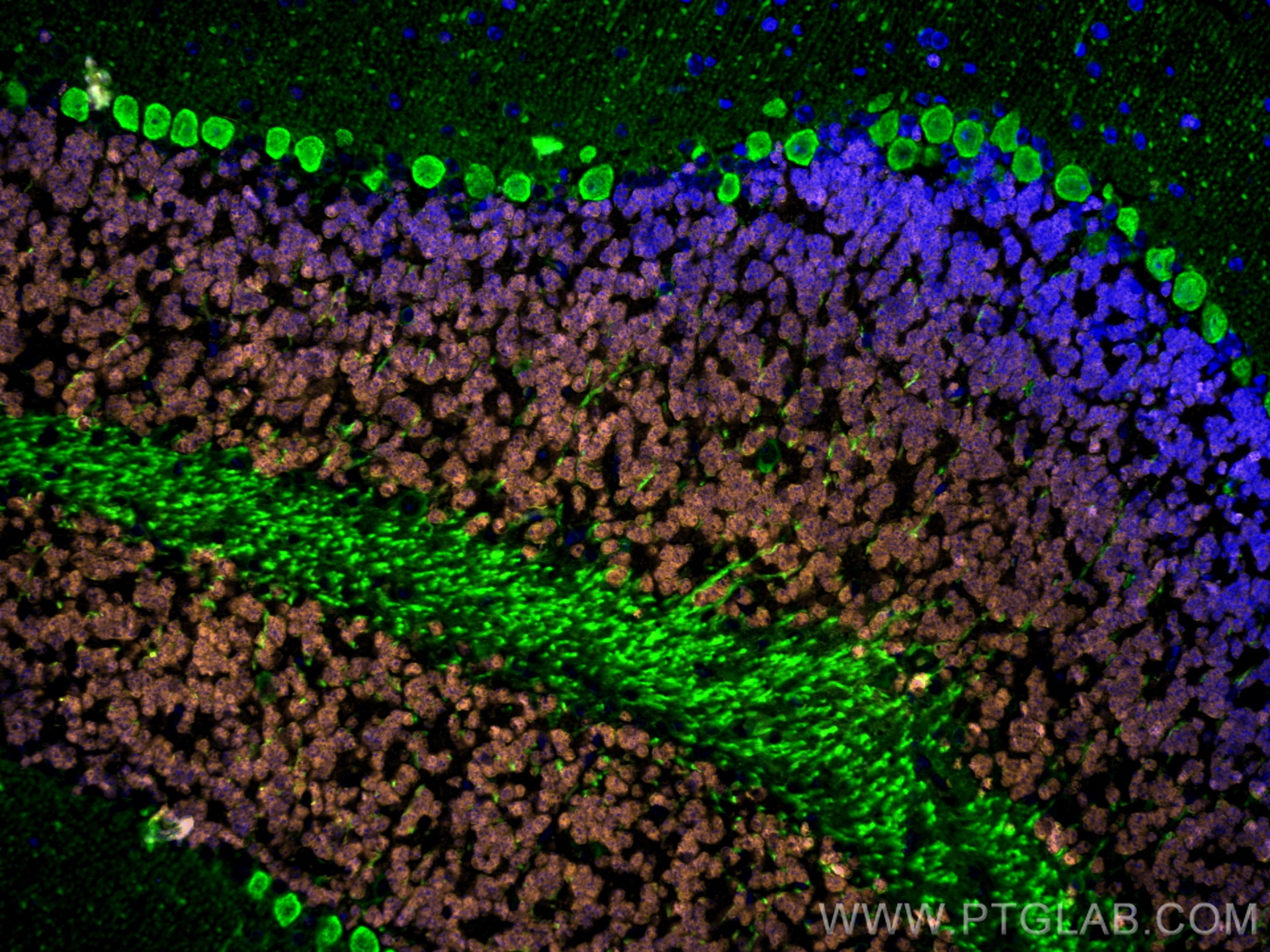 Immunofluorescence of mouse cerebellum: mouse cerebellum FFPE section was stained with Rabbit anti-NeuN polyclonal antibody (26975-1-AP, 1:200, orange) and mouse anti-Calbindin-D28k monoclonal antibody (66394-1-Ig, 1:200, green). Multi-rAb CoraLite® Plus 555 conjugated Recombinant Goat anti-rabbit secondary antibody (RGAR003, 1:500) and Multi-rAb CoraLite® Plus 488 conjugated Goat Anti-Mouse Recombinant Secondary Antibody (H+L) were used for detection (RGAM002, 1:500) .