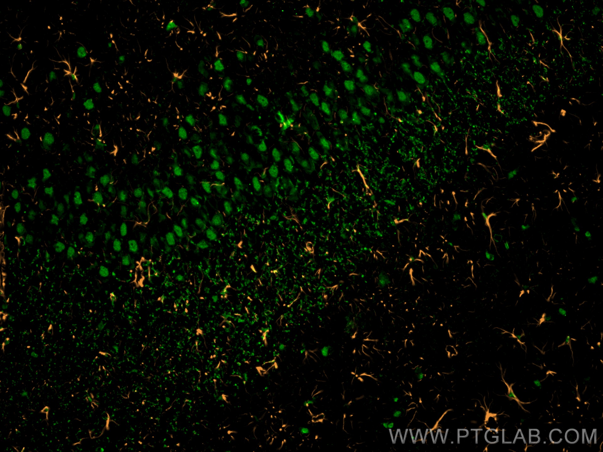 Immunofluorescence of rat brain: rat brain FFPE section was stained with Rabbit anti-GFAP polyclonal antibody (16825-1-AP, 1:200, orange) and mouse anti-NeuN monoclonal antibody (66836-1-Ig, green). Multi-rAb CoraLite® Plus 555 conjugated Recombinant Goat anti-rabbit secondary antibody (RGAR003, 1:500) and Multi-rAb CoraLite® Plus 488 conjugated Goat Anti-Mouse Recombinant Secondary Antibody (H+L) were used for detection (RGAM002, 1:500) . 