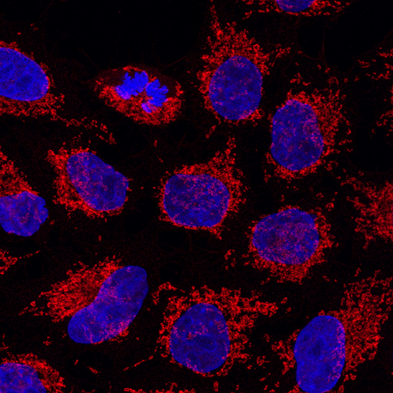 Immunofluorescence of Hela cells: Hela cells were fixed with 4% PFA and stained with Rabbit anti-TOM70 polyclonal antibody (14528-1-AP, 1:200) Multi-rAb CoraLite® Plus 555 conjugated Goat Anti-Rabbit Recombinant Secondary Antibody (H+L) (RGAR003, 1:600) was used for detection. Nucleus was stained with DAPI(blue). The experiment was performed in Chromotek’s lab and image was recorded at the Core Facility Bioimaging at the Biomedical Center, LMU Munich.