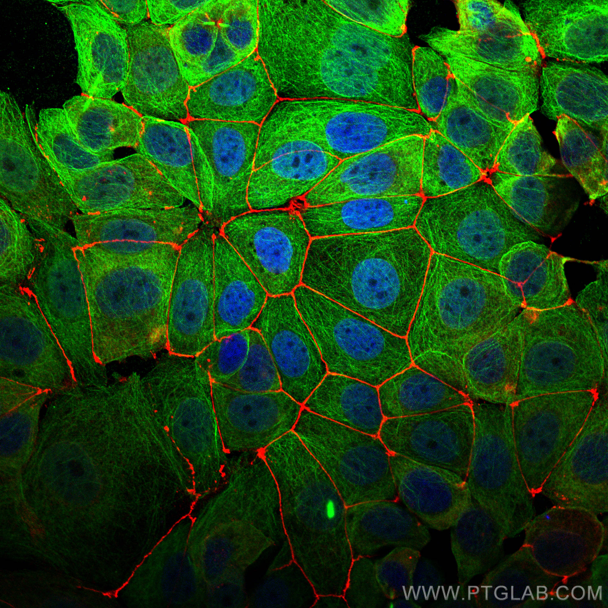 Immunofluorescence of MCF-7 cells: MCF-7 cells were fixed with 4% PFA and stained with Rabbit anti-ZO1 polyclonal antibody (21773-1-AP, 1:2000, red) and mouse anti-Alpha Tubulin monoclonal antibody (66031-1-Ig, 1:1000, green). Multi-rAb CoraLite® Plus 594-Goat Anti-Rabbit Recombinant Secondary Antibody (H+L) (RGAR004, 1:500) and Multi-rAb CoraLite® Plus 488-Goat Anti-Mouse Recombinant Secondary Antibody (H+L) (RGAM002, 1:500) were used for detection.