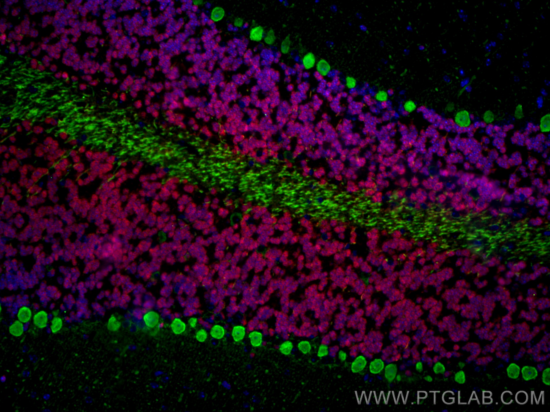 Immunofluorescence of mouse cerebellum: mouse cerebellum FFPE section was stained with Rabbit anti-NeuN polyclonal antibody (26975-1-AP, 1:200, red) and mouse anti-Calbindin-D28k monoclonal antibody (66394-1-Ig, 1:200, green). Multi-rAb CoraLite® Plus 594 conjugated Recombinant Goat anti-rabbit secondary antibody (RGAR004, 1:500) and Multi-rAb CoraLite® Plus 488 conjugated Goat Anti-Mouse Recombinant Secondary Antibody (H+L) were used for detection (RGAM002, 1:500) . 