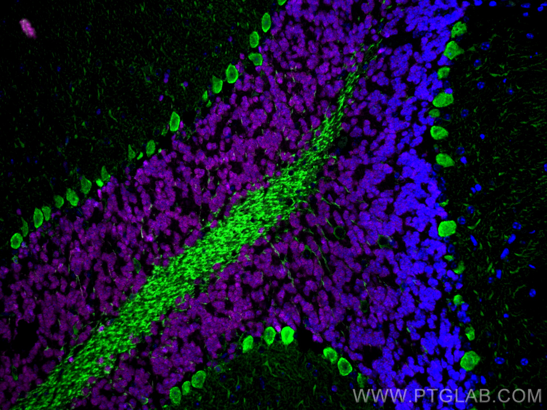 Immunofluorescence of mouse cerebellum: mouse cerebellum FFPE section was stained with Rabbit anti-NeuN polyclonal antibody (26975-1-AP, 1:200, magenta) and mouse anti-Calbindin-D28k monoclonal antibody (66394-1-Ig, 1:200, green). Multi-rAb CoraLite® Plus 647 conjugated Recombinant Goat anti-rabbit secondary antibody (RGAR005, 1:500) and Multi-rAb CoraLite® Plus 488 conjugated Goat Anti-Mouse Recombinant Secondary Antibody (H+L) were used for detection (RGAM002, 1:500) . 