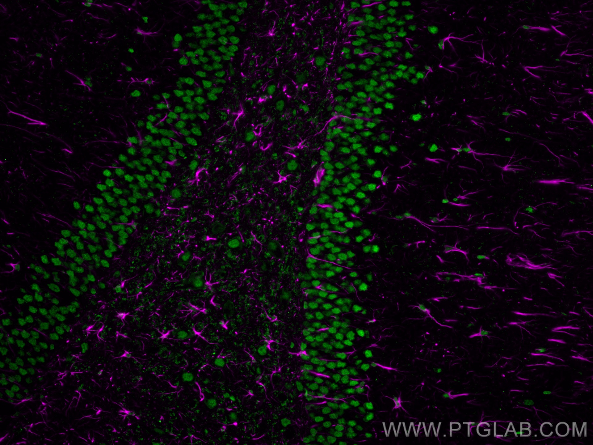 Immunofluorescence of rat brain: rat brain FFPE section was stained with Rabbit anti-GFAP polyclonal antibody (16825-1-AP, 1:200, magenta) and mouse anti-NeuN monoclonal antibody (66836-1-Ig, green). Multi-rAb CoraLite® Plus 647 conjugated Recombinant Goat anti-rabbit secondary antibody (RGAR005, 1:500) and Multi-rAb CoraLite® Plus 488 conjugated Goat Anti-Mouse Recombinant Secondary Antibody (H+L) were used for detection (RGAM002, 1:500) . 