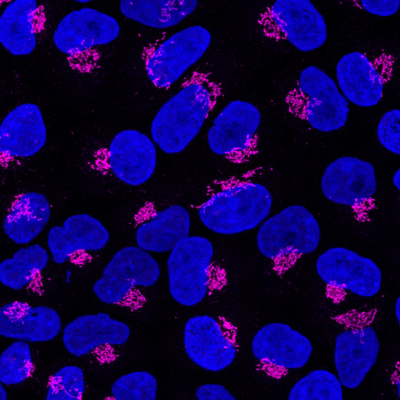 Immunofluorescence of Hela cells: Hela cells were fixed with 4% PFA and stained with Rabbit anti-GM130 polyclonal antibody (11308-1-AP, 1:200) Multi-rAb CoraLite® Plus 647 conjugated Goat Anti-Rabbit Recombinant Secondary Antibody (H+L) (RGAR005,1:800) was used for detection. Nucleus was stained with DAPI (blue).
    The experiment was performed in Chromotek’s lab and image was recorded at the Core Facility Bioimaging at the Biomedical Center, LMU Munich.