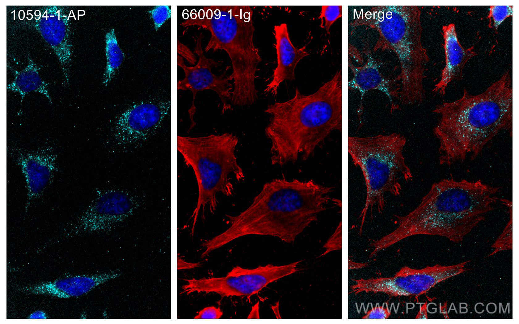 Immunofluorescent analysis of (-20°C Methanol) fixed HeLa cells using PEX14 antibody (10594-1-AP) at dilution of 1:200 and Multi-rAb CoraLite® Plus 750-Goat Anti-Rabbit Recombinant Secondary Antibody (H+L) (RGAR006), Beta Actin antibody (66009-1-Ig, Clone: 2D4H5). 