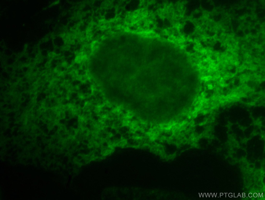 Immunofluorescent analysis of A431 cells, using Calnexin antibody 10427-2-AP at 1:50 dilution and SA00003-8 Fluorescein (FITC)–conjugated Affinipure Donkey Anti-Rabbit IgG(H+L).