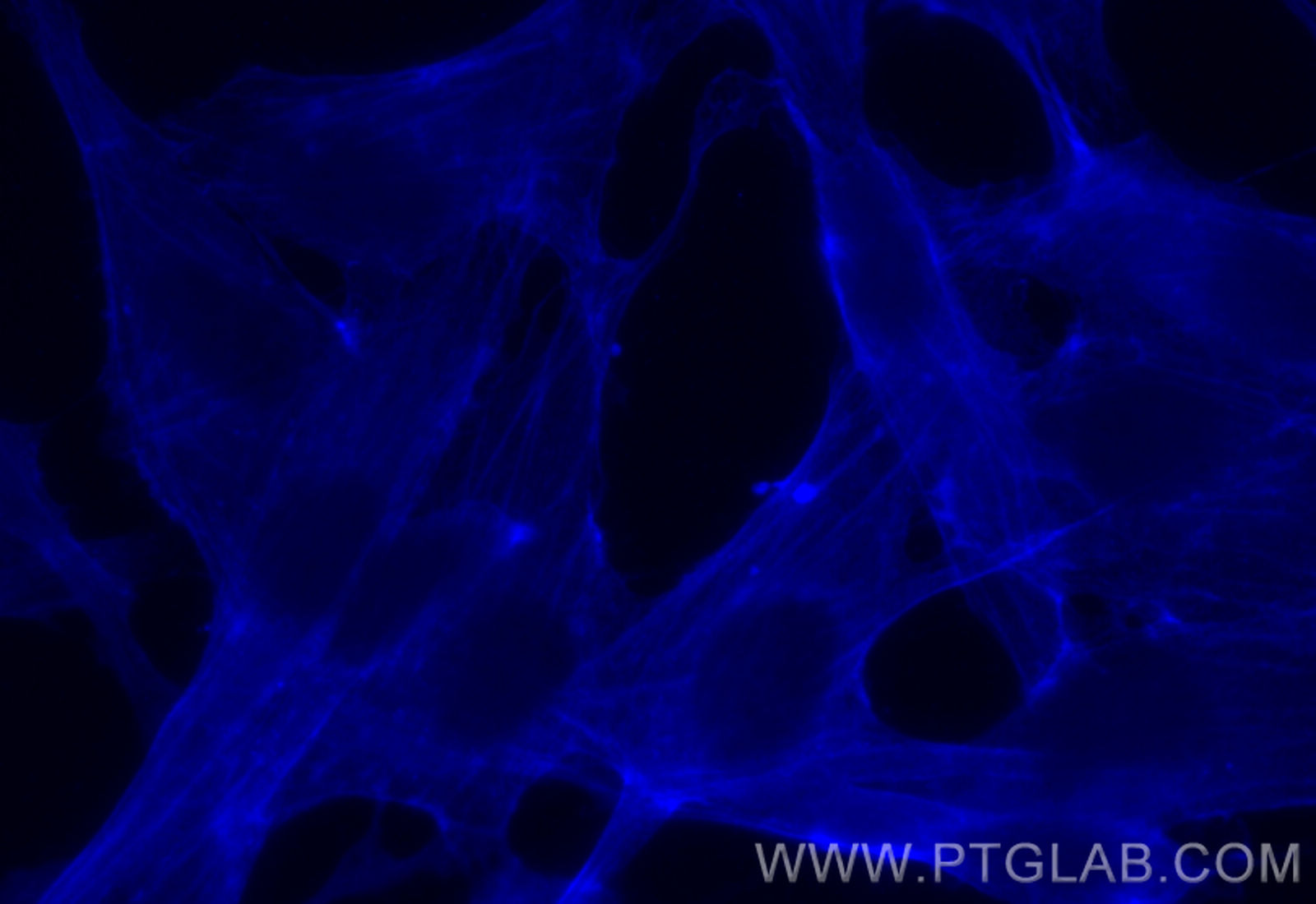 Immunofluorescent analysis of (-20°C Methanol) fixed MDCK cells using Beta Actin antibody (66009-1-Ig, Clone: 2D4H5 ) at dilution of 1:400 and AMCA-conjugated Goat Anti-Mouse IgG(H+L)(SA00010-1).