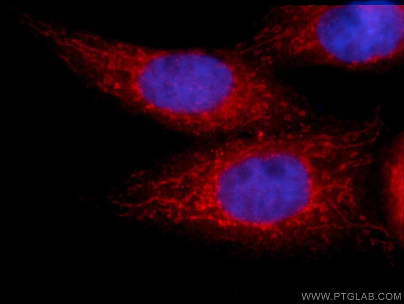 Immunofluorescent analysis of HepG2 cells using 19842-1-AP (hIST1 antibody) at dilution of 1:25 and SA00013-4 CoraLite594-conjugated Goat Anti-Rabbit IgG(H+L).