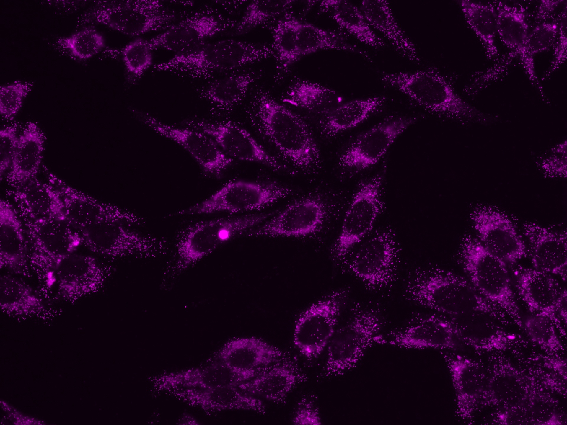 Immunofluorescent analysis of (4% PFA) fixed HeLa cells using 10594-1-AP (PEX14 antiboody) and CoraLite®647 conjugated AffiniPure F(ab')2 Fragment Donkey Anti-Rabbit IgG (H+L) antibody (SA00014-7) at dilution of 1:150.