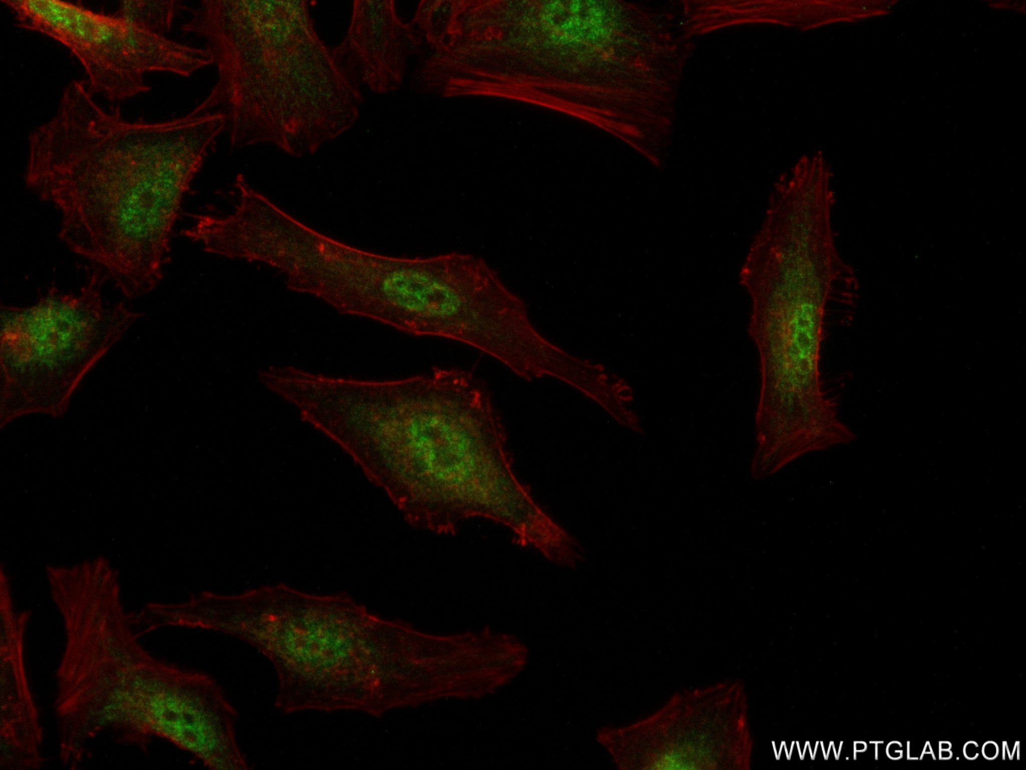 Immunofluorescence (IF) / fluorescent staining of HeLa cells using IFI35 Recombinant antibody (83160-2-RR)