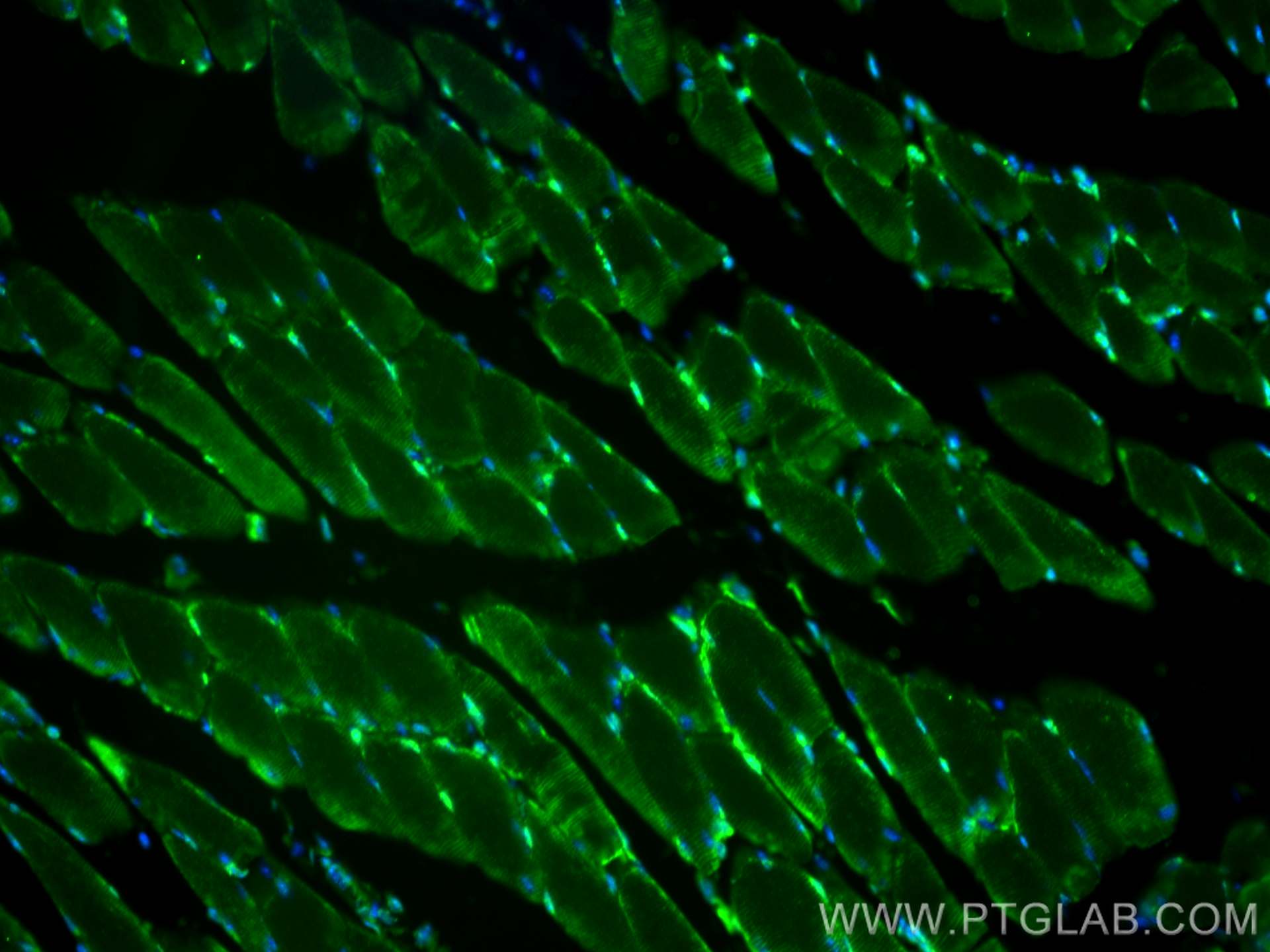 Immunofluorescence (IF) / fluorescent staining of mouse skeletal muscle tissue using CoraLite®488-conjugated IFIH1 Polyclonal antibody (CL488-21775)