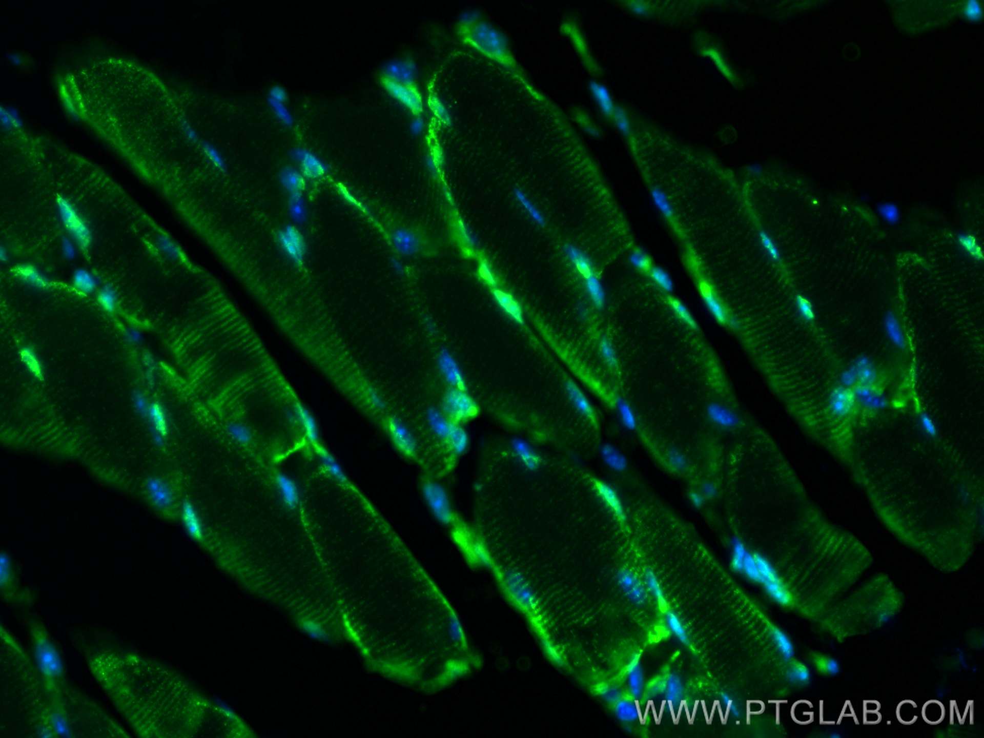 Immunofluorescence (IF) / fluorescent staining of mouse skeletal muscle tissue using CoraLite®488-conjugated IFIH1 Polyclonal antibody (CL488-21775)