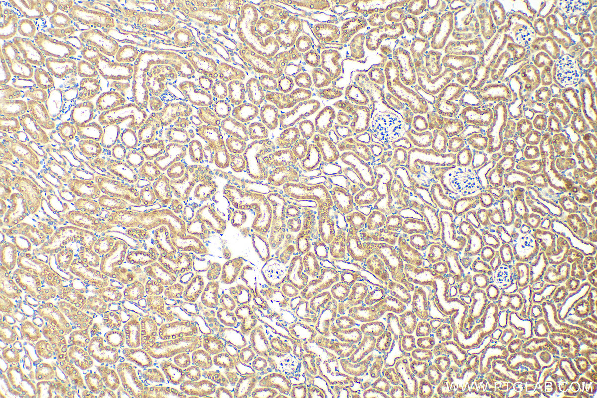 Immunohistochemistry (IHC) staining of mouse kidney tissue using IFIT1 Polyclonal antibody (23247-1-AP)